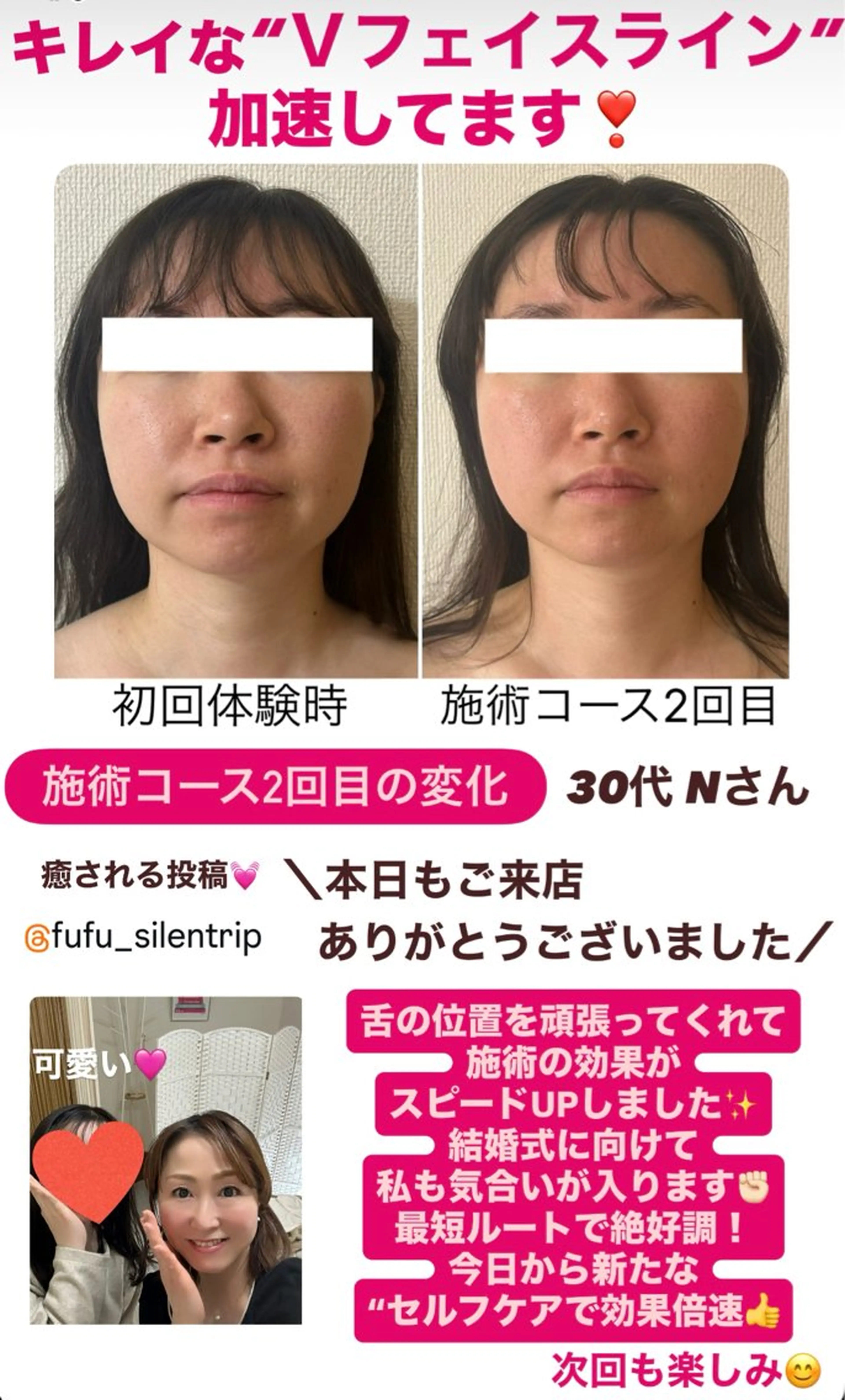 la lumie're (ラ リュミエール)所属・小顔サロン (ラ リュミエール)のエステ・リラクイメージ