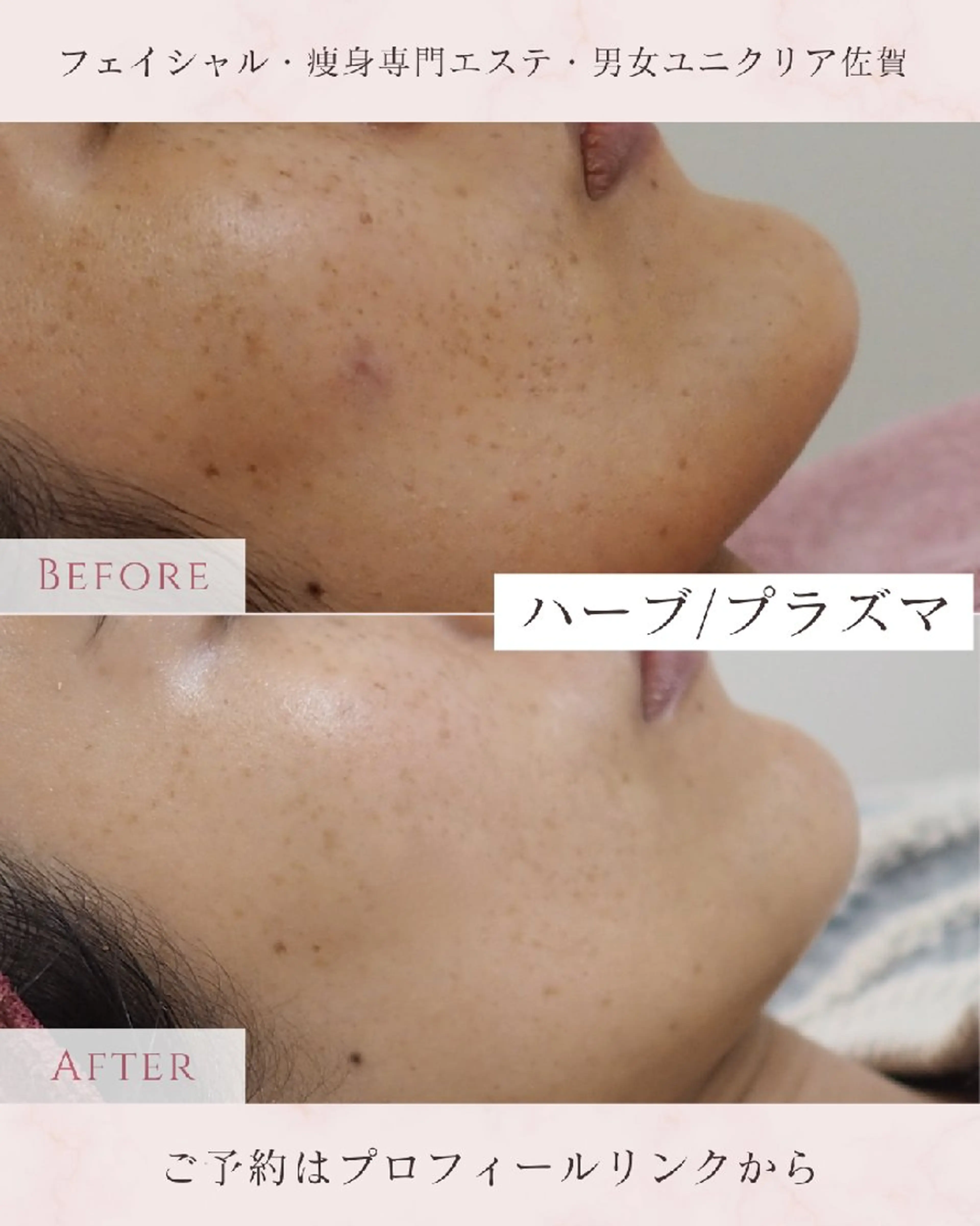 エステ ユニセックスエステサロンUniclear所属・痩身&フェイシャル Uniclearのエステ・リラクイメージ