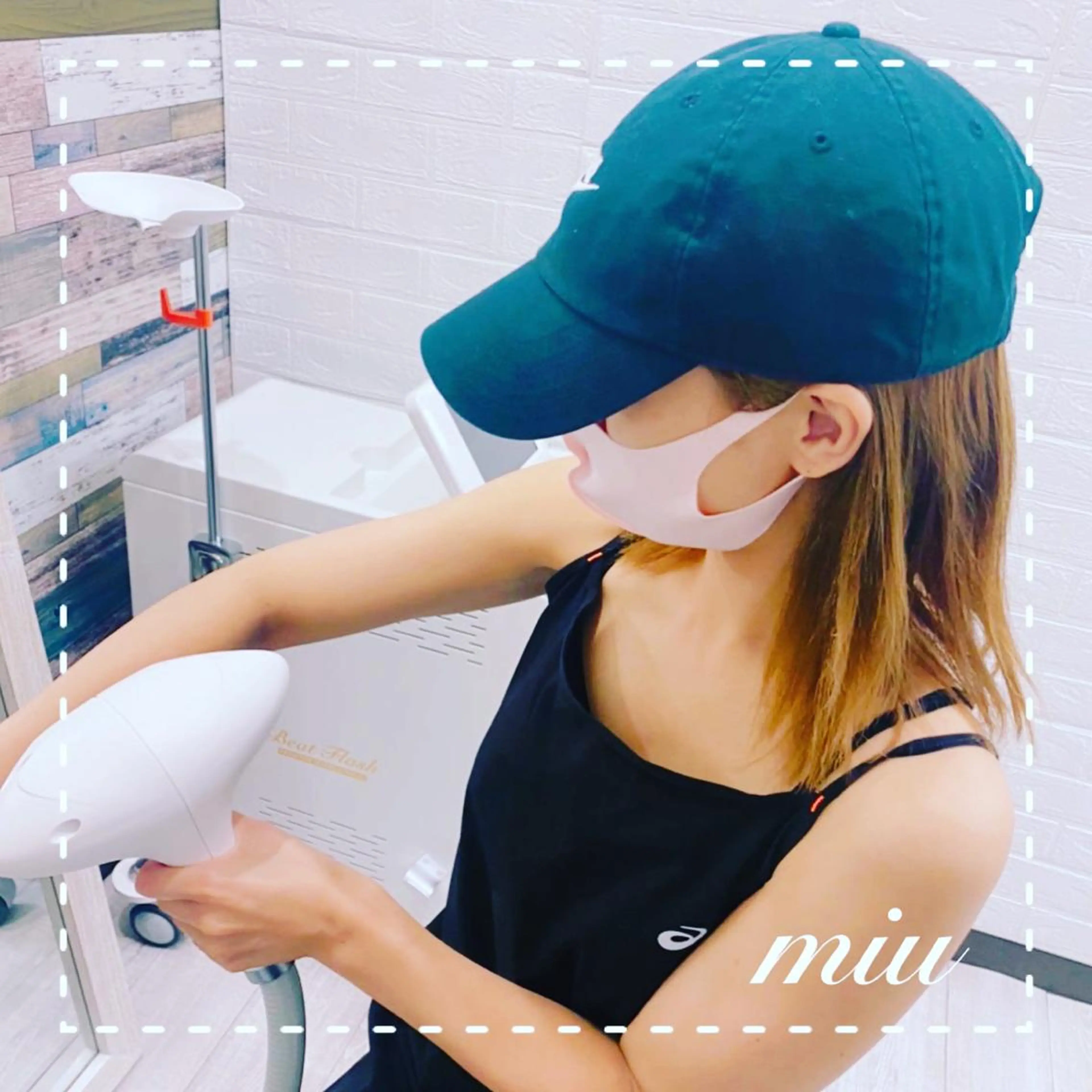 セルフ脱毛２０分【部分脱毛】大パーツ3箇所程度の写真