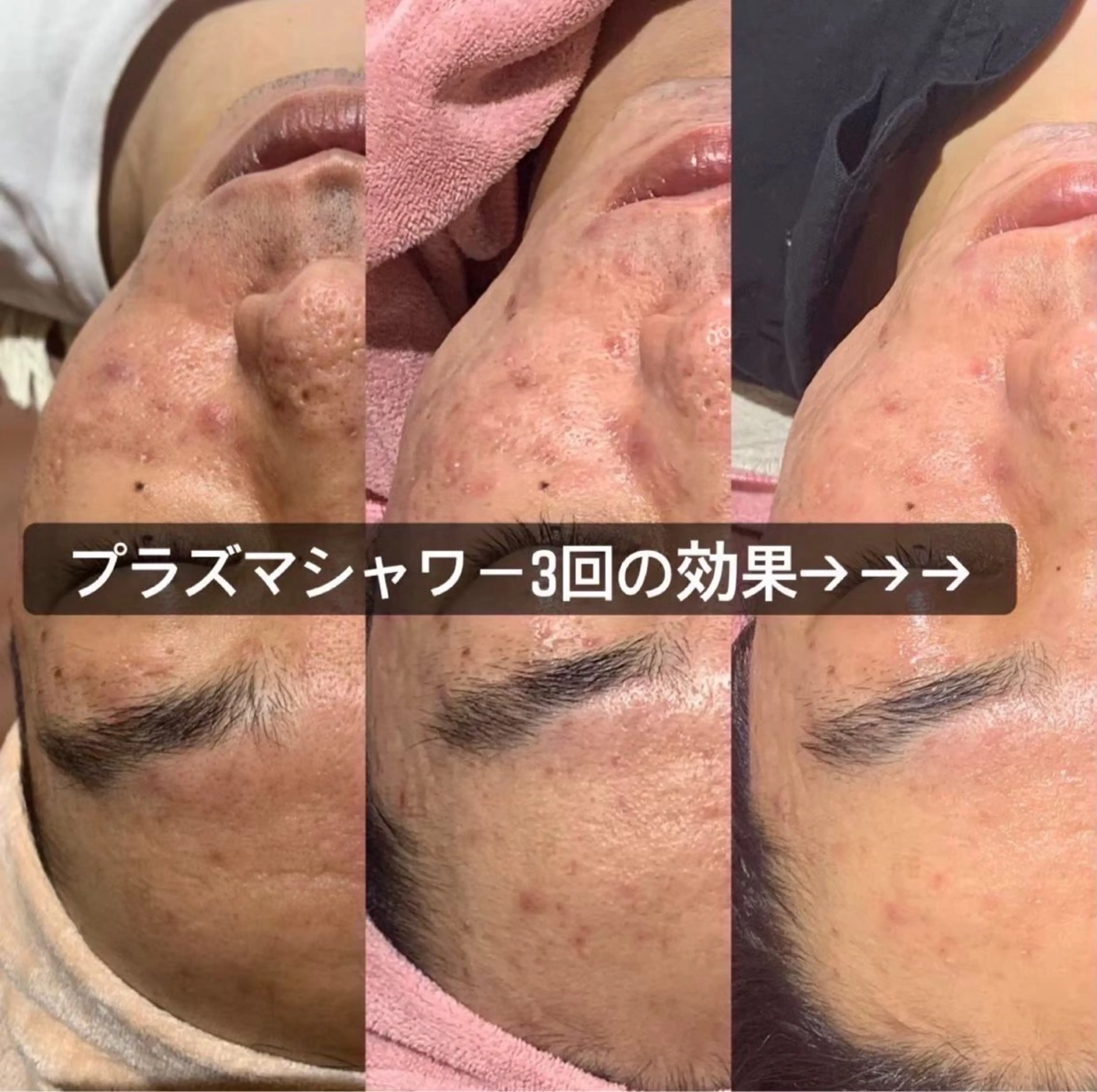 EARTH coiffure beaute 小山店所属・EARTH 小山店 shimaのエステ・リラクイメージ