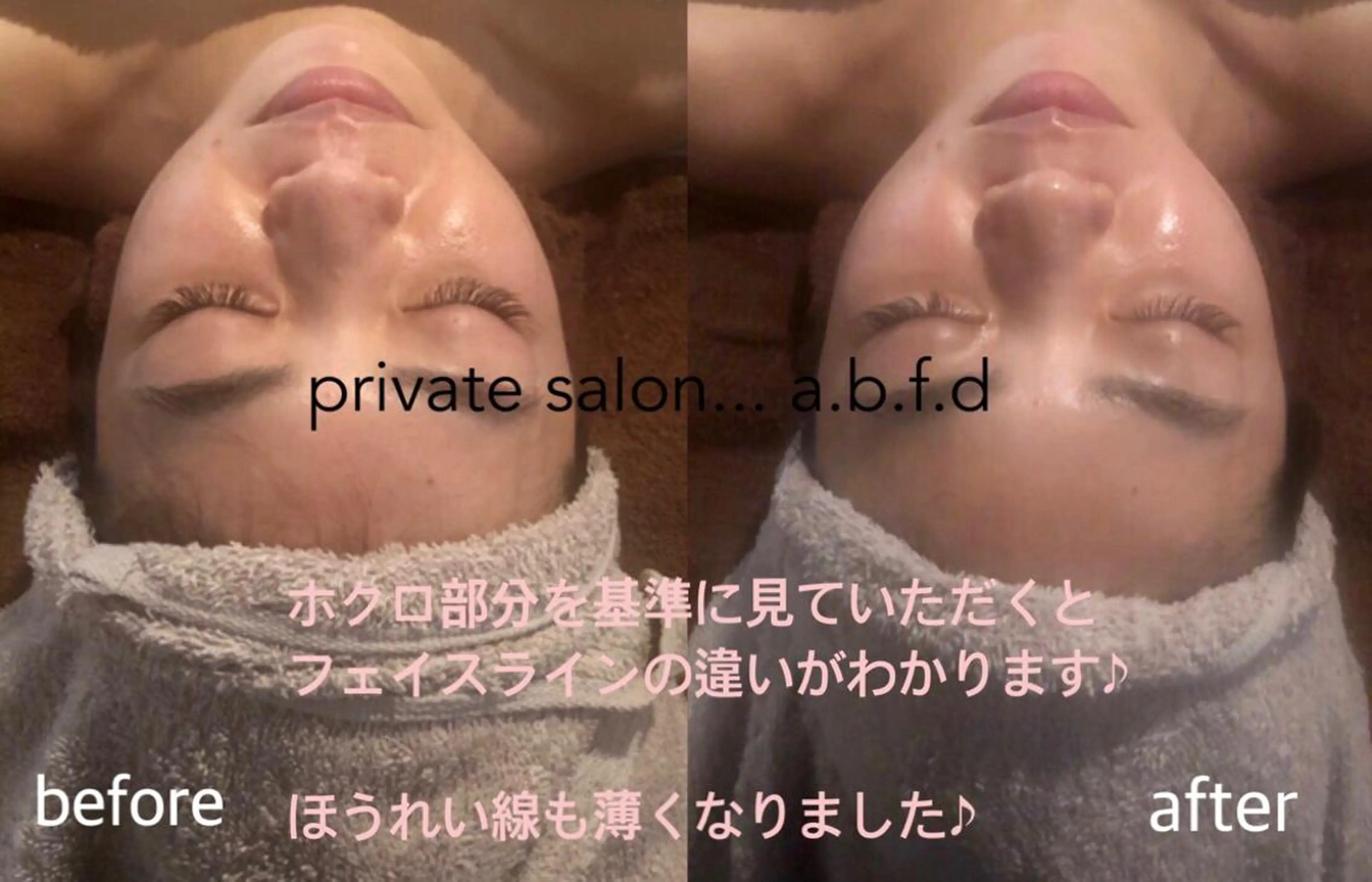 エステ リラク プライベートサロン a.b.f.dのネイルデザイン