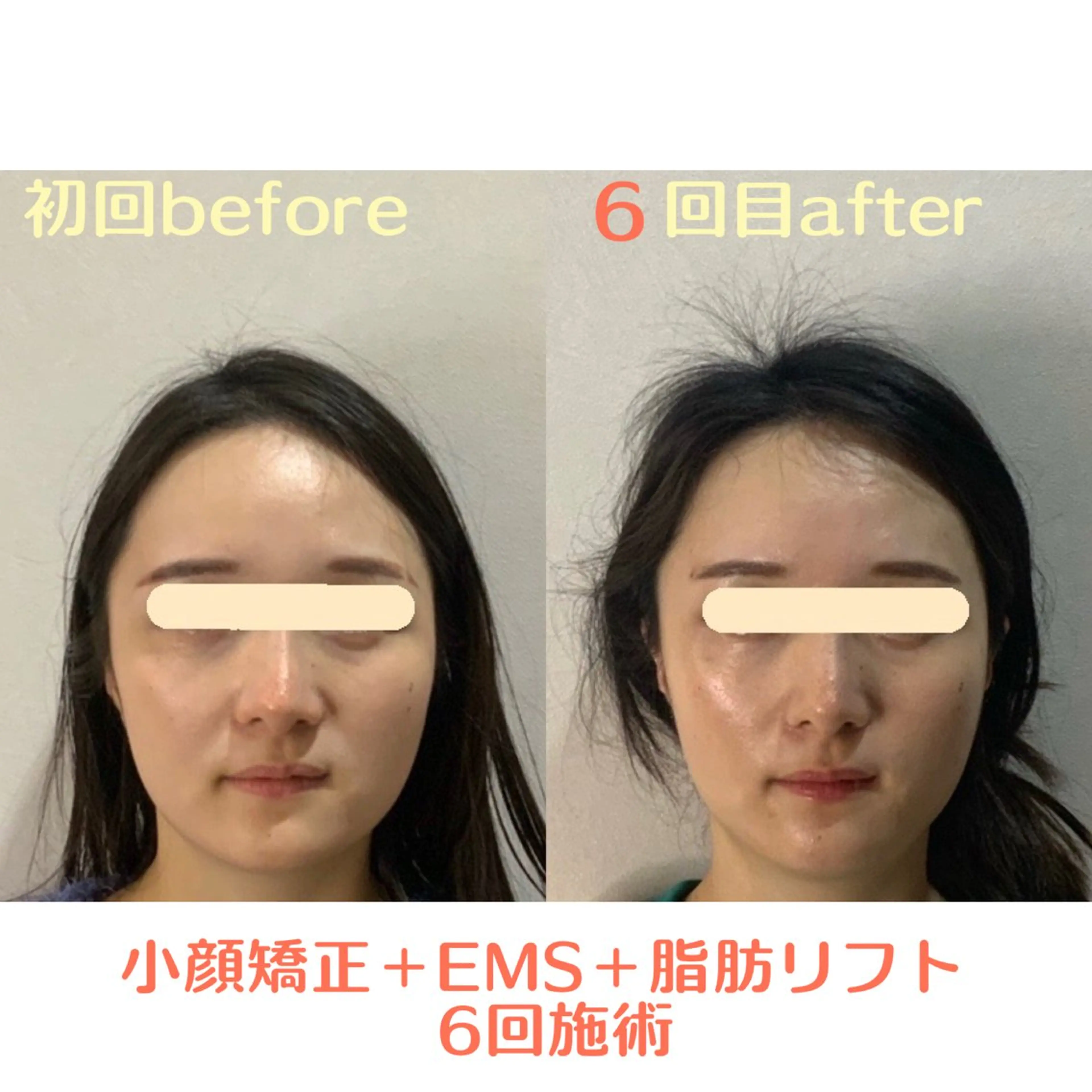 エステ 小顔・肌質改善 espoir 心斎橋のエステ・リラクイメージ