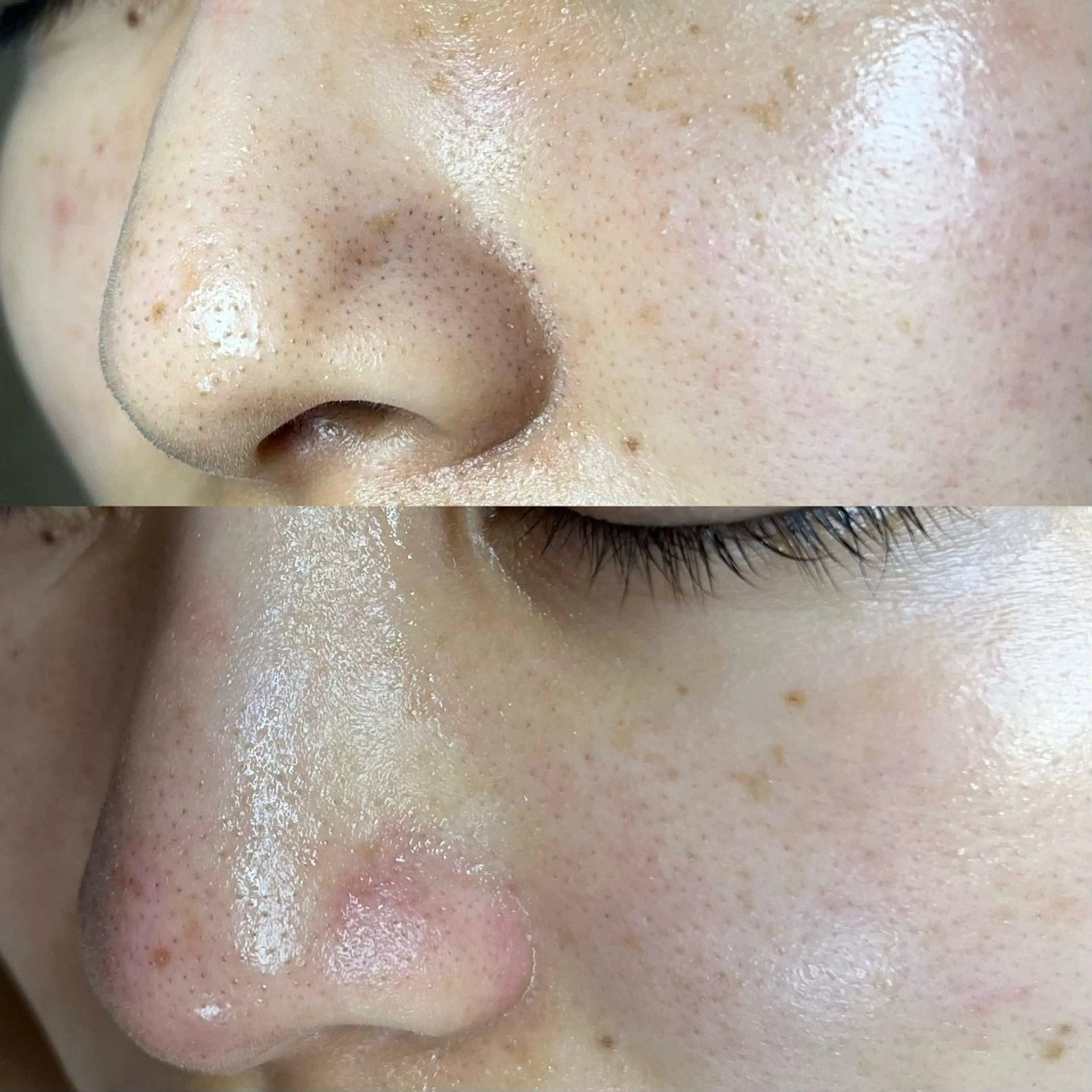 毛穴ケア・ヘッドスパサロンSHINY(シャイニー)所属・毛穴ケア・ヘッドスパ サロンSHINYのエステ・リラクイメージ