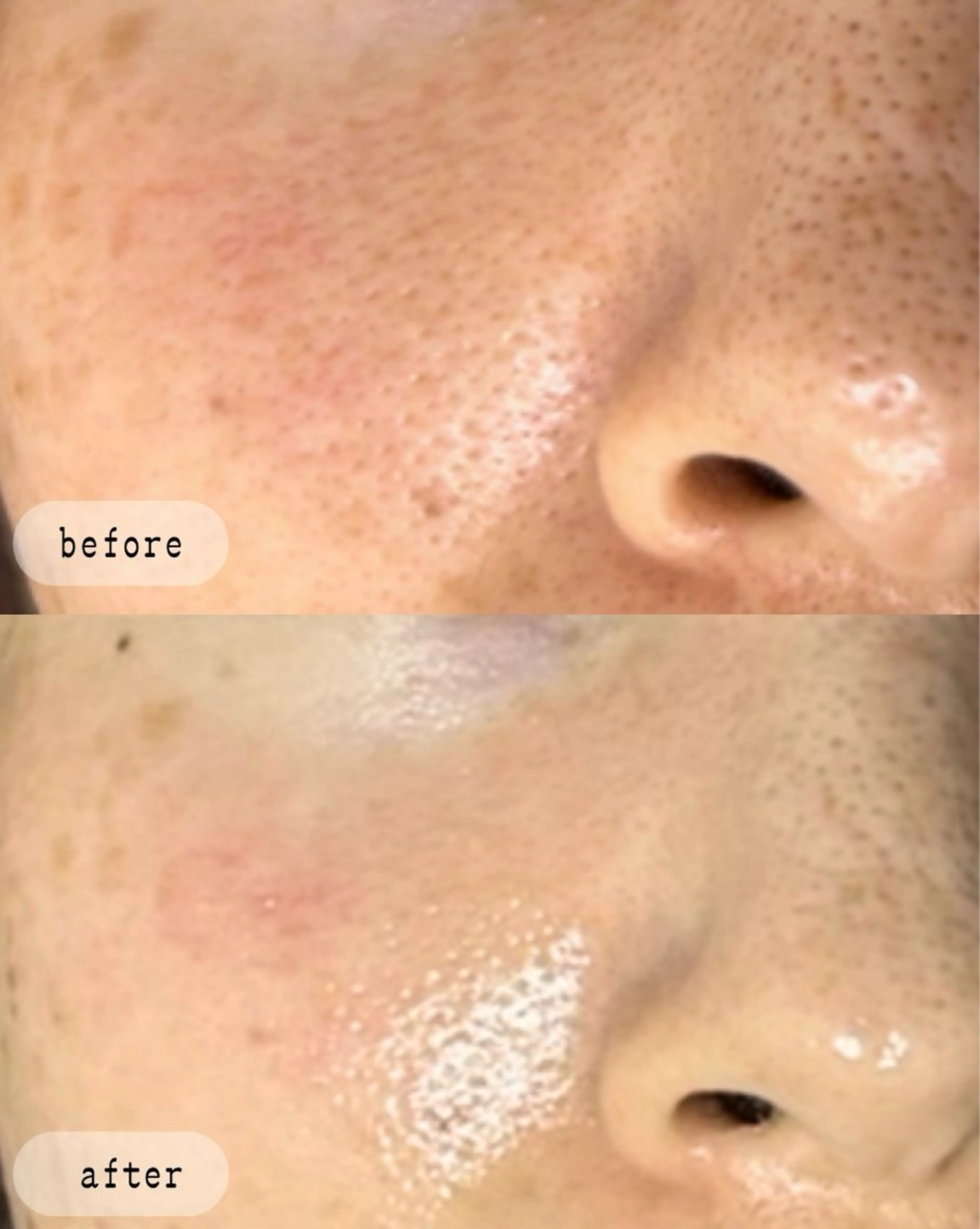 エステ LaVibe ann.のエステ・リラクイメージ