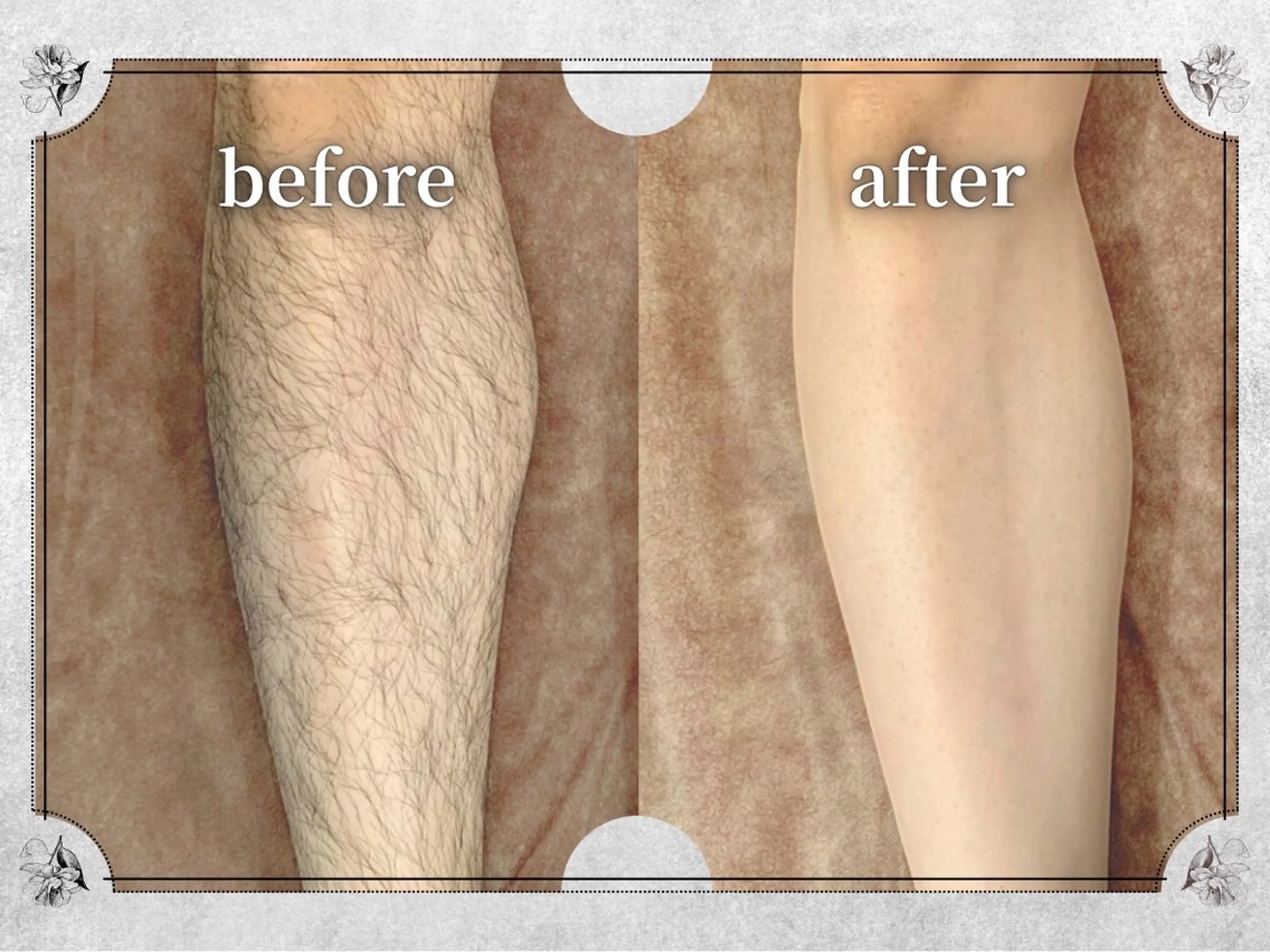 都度払い 脱毛 Lino柏/moeのエステ・リラクイメージ