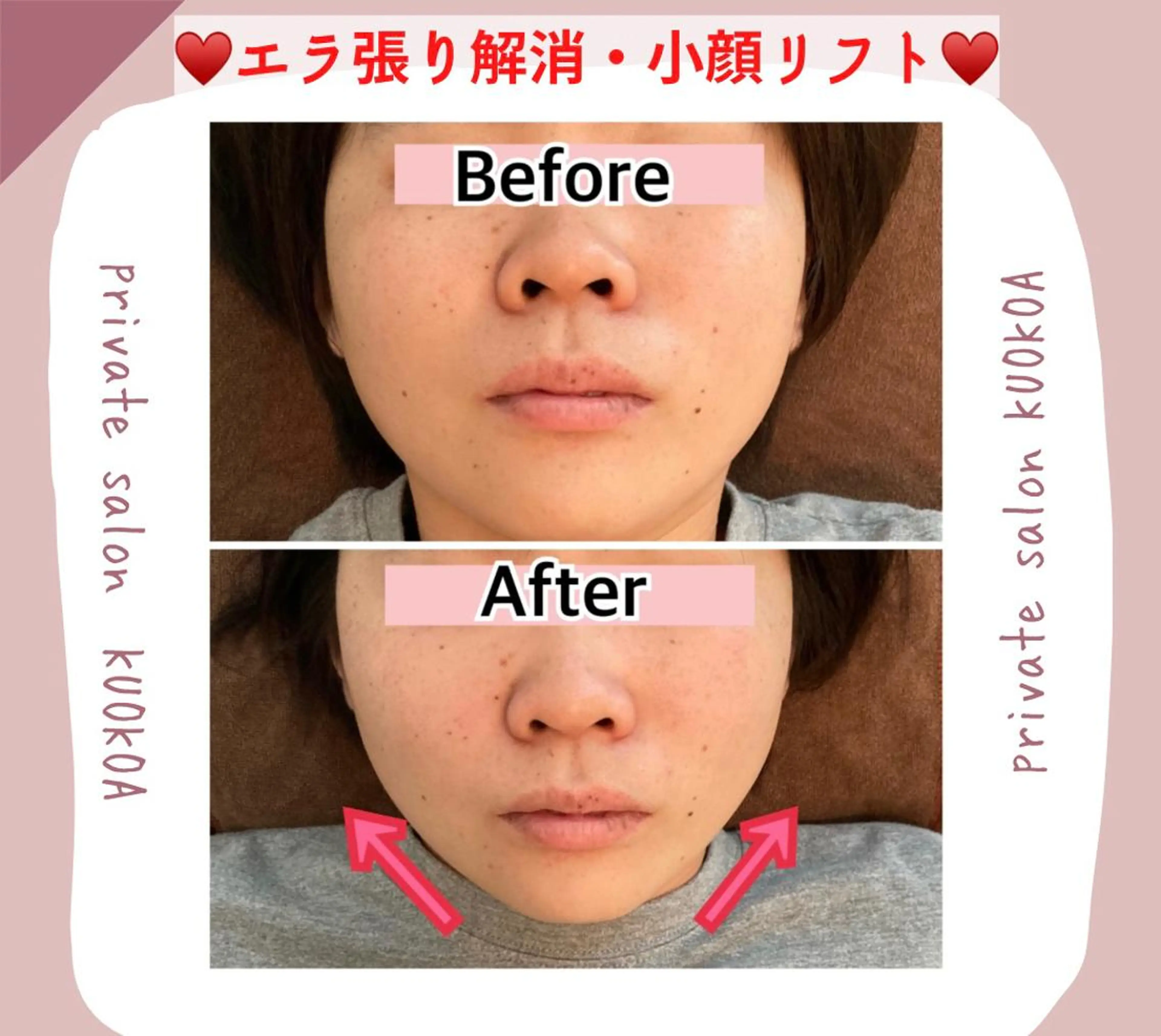 中目黒  整体 小顔 KUOKOAのエステ・リラクイメージ