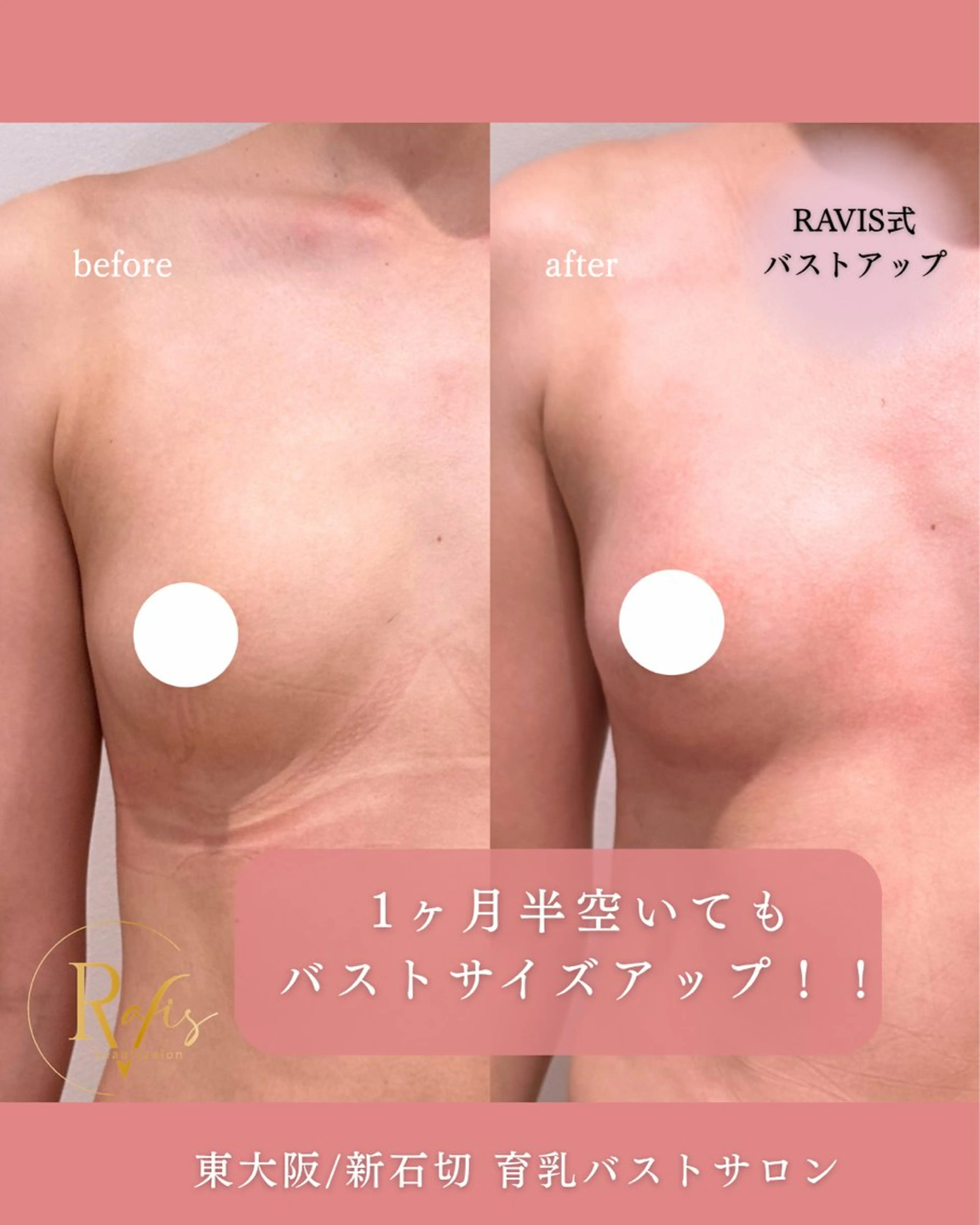 beautysalon RAVIS所属・東大阪/韓国肌管理/ 痩身バスト専門店のエステ・リラクイメージ