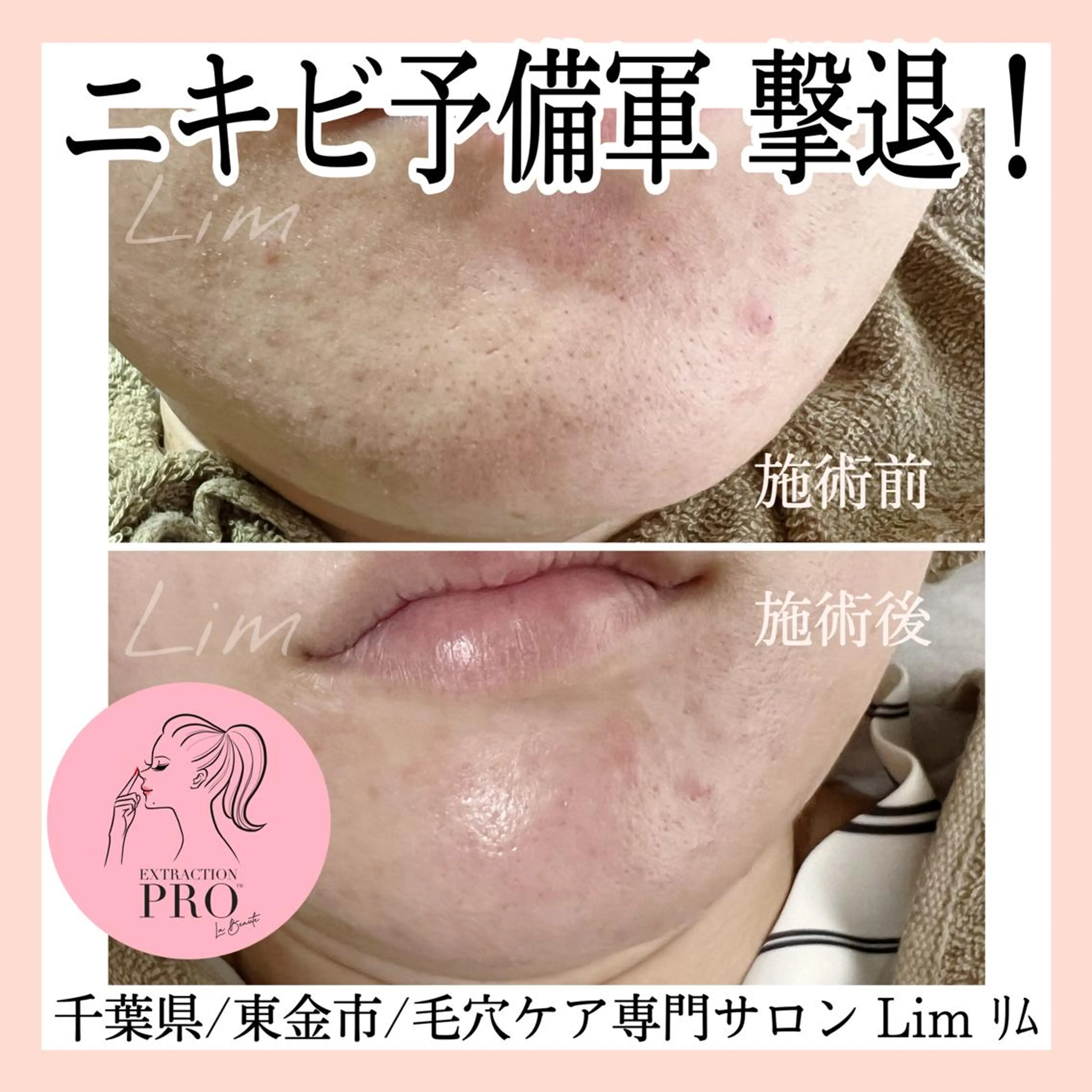 Lim Naomiのマツエク・マツパデザイン