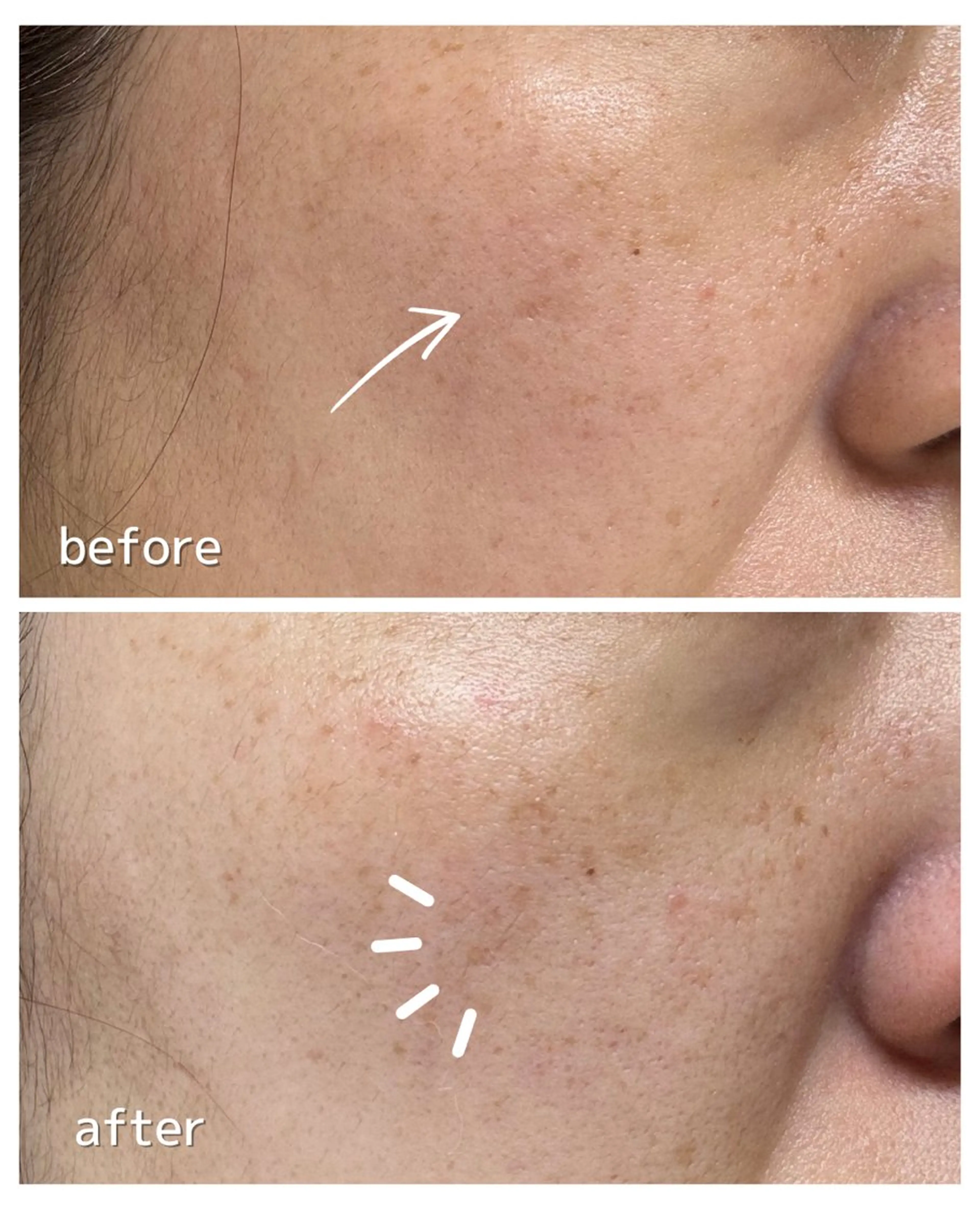 BellaLuna 金子のエステ・リラクイメージ