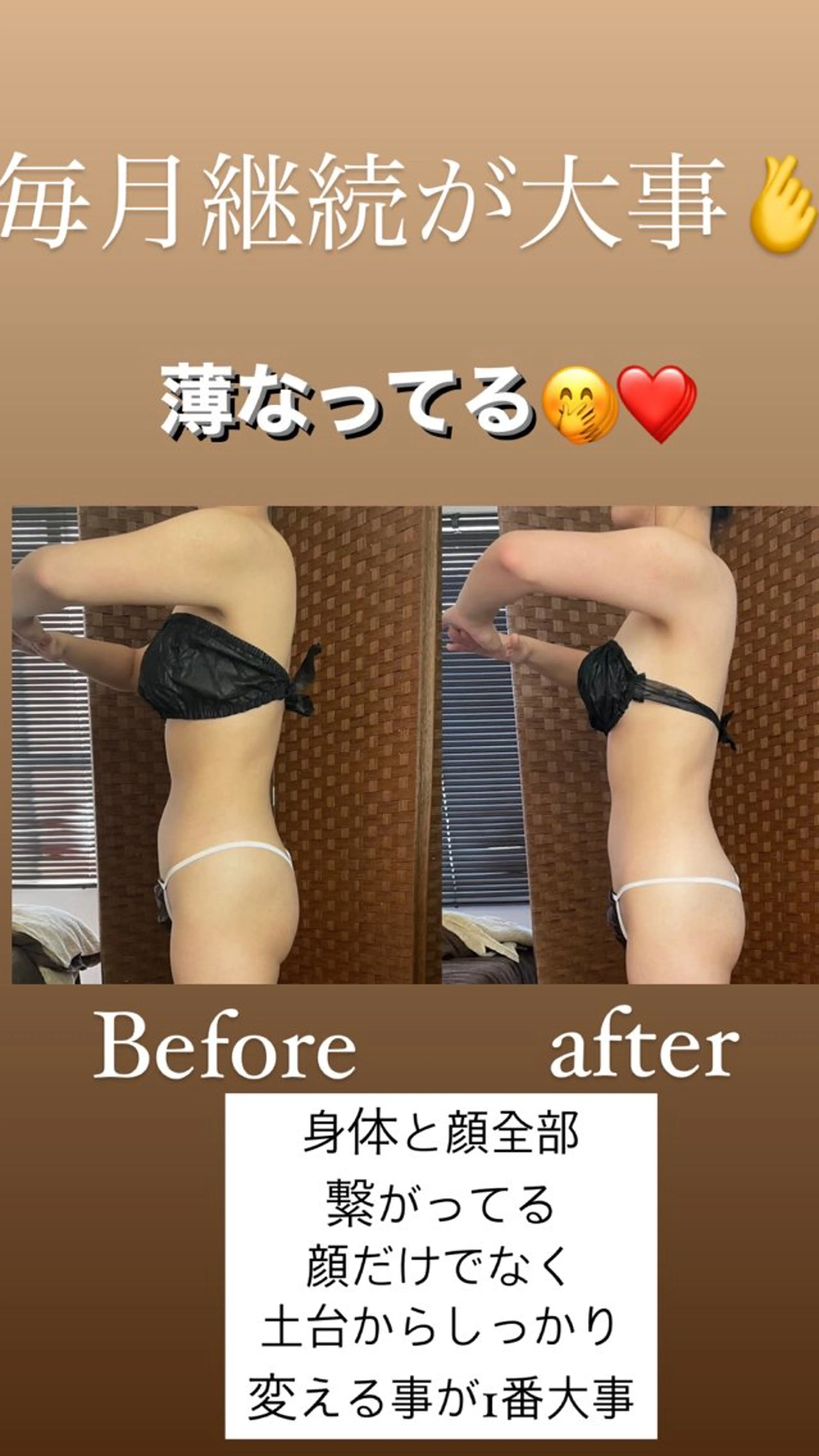 ハイパーナイフ✨（ブライダル可）上半身美人コース（顔含みません）の写真