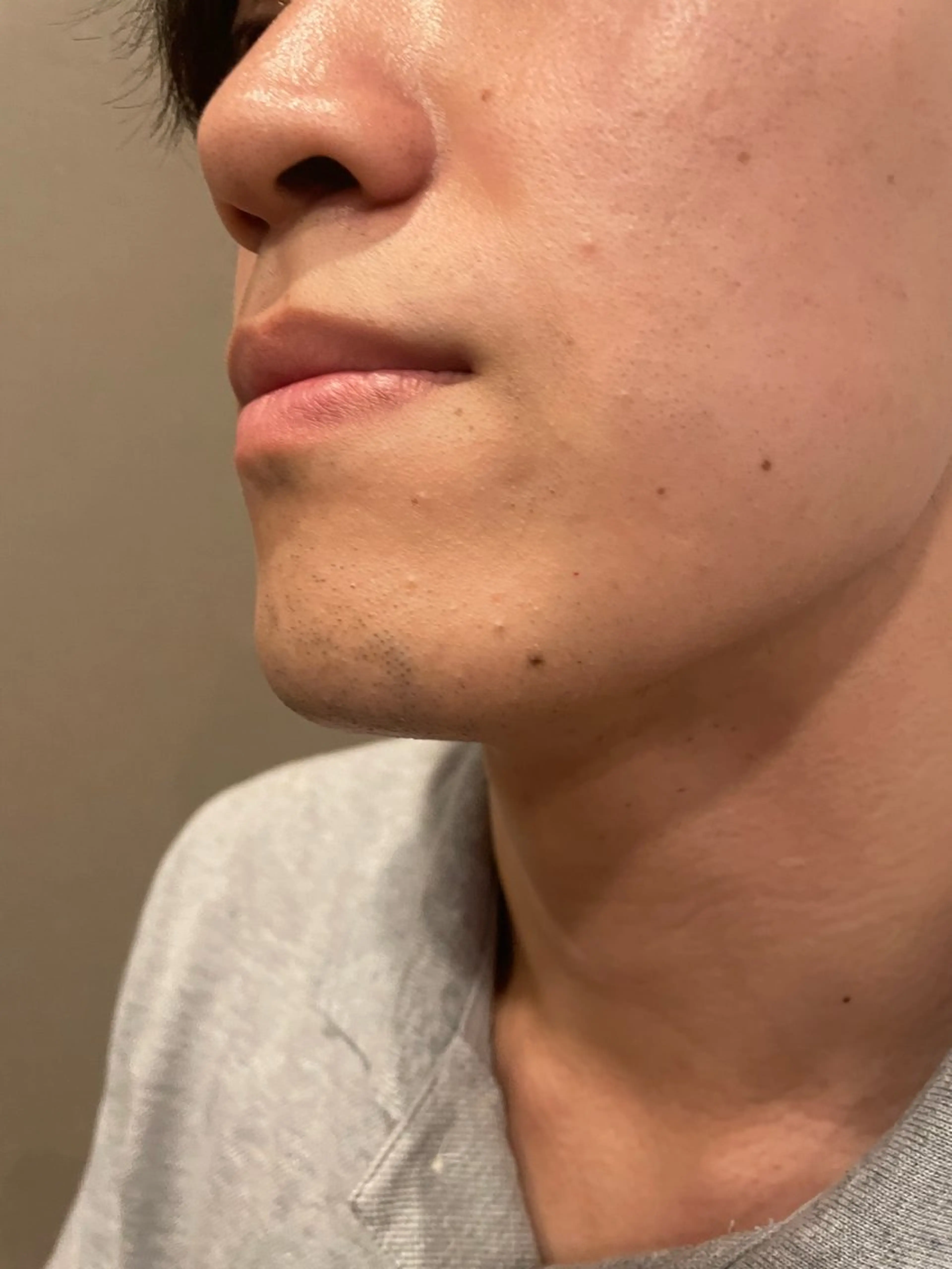 🍃学割🍃男性髭脱毛　(保湿パック　ヘッドマッサージ付き)🍃ミニモ限定初回の写真