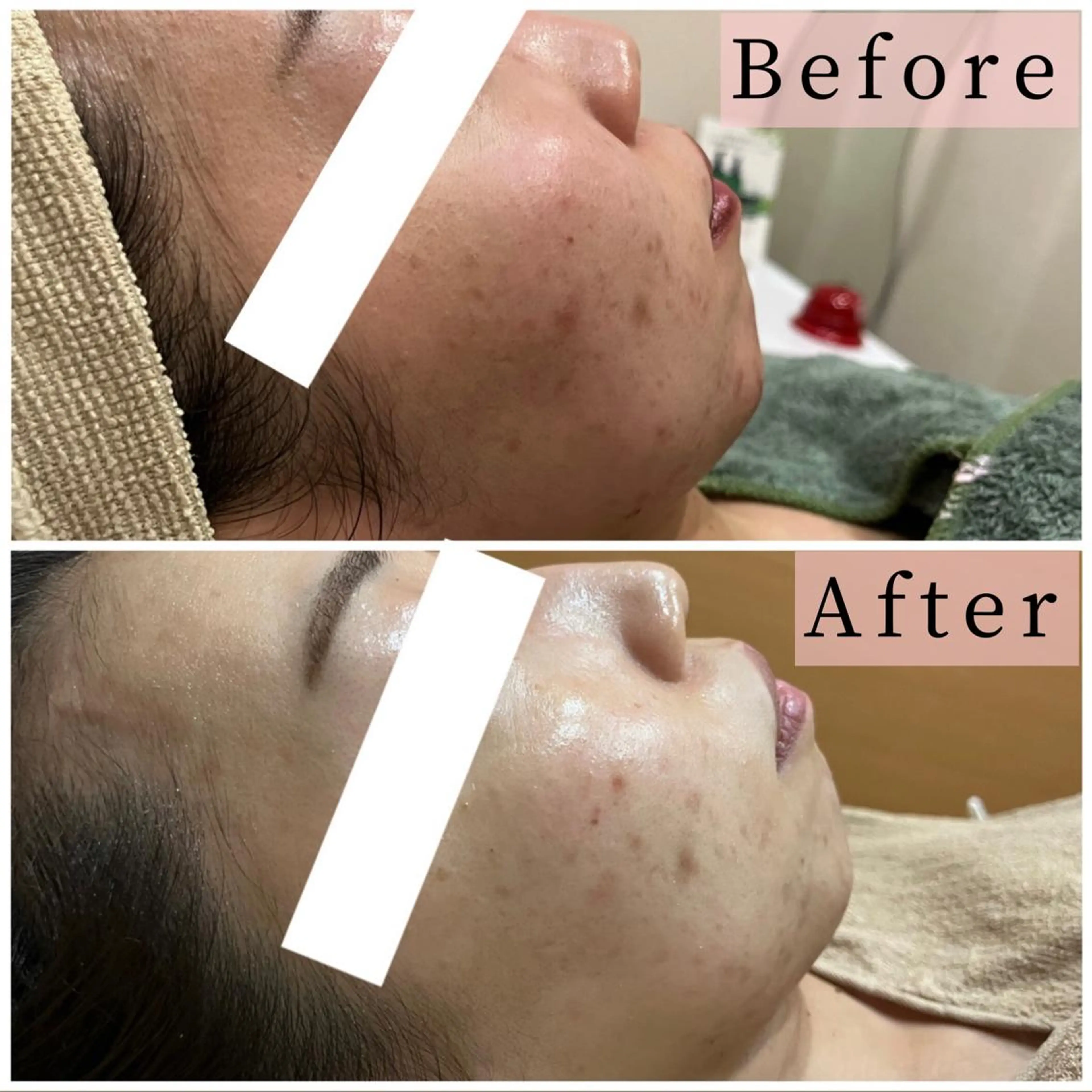 ハーブピーリング専門 muro.のエステ・リラクイメージ