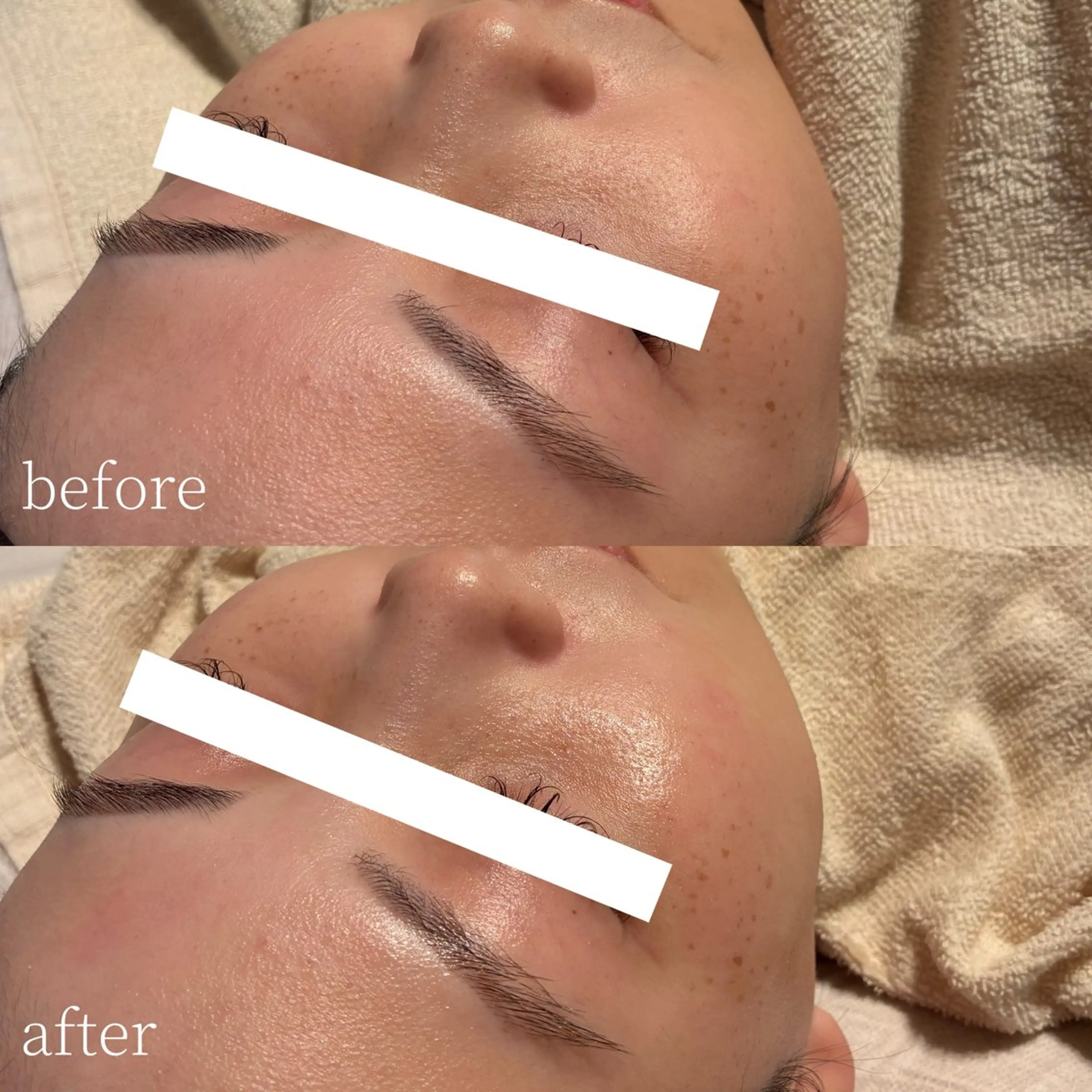 脱毛 Erika komorebi_のエステ・リラクイメージ