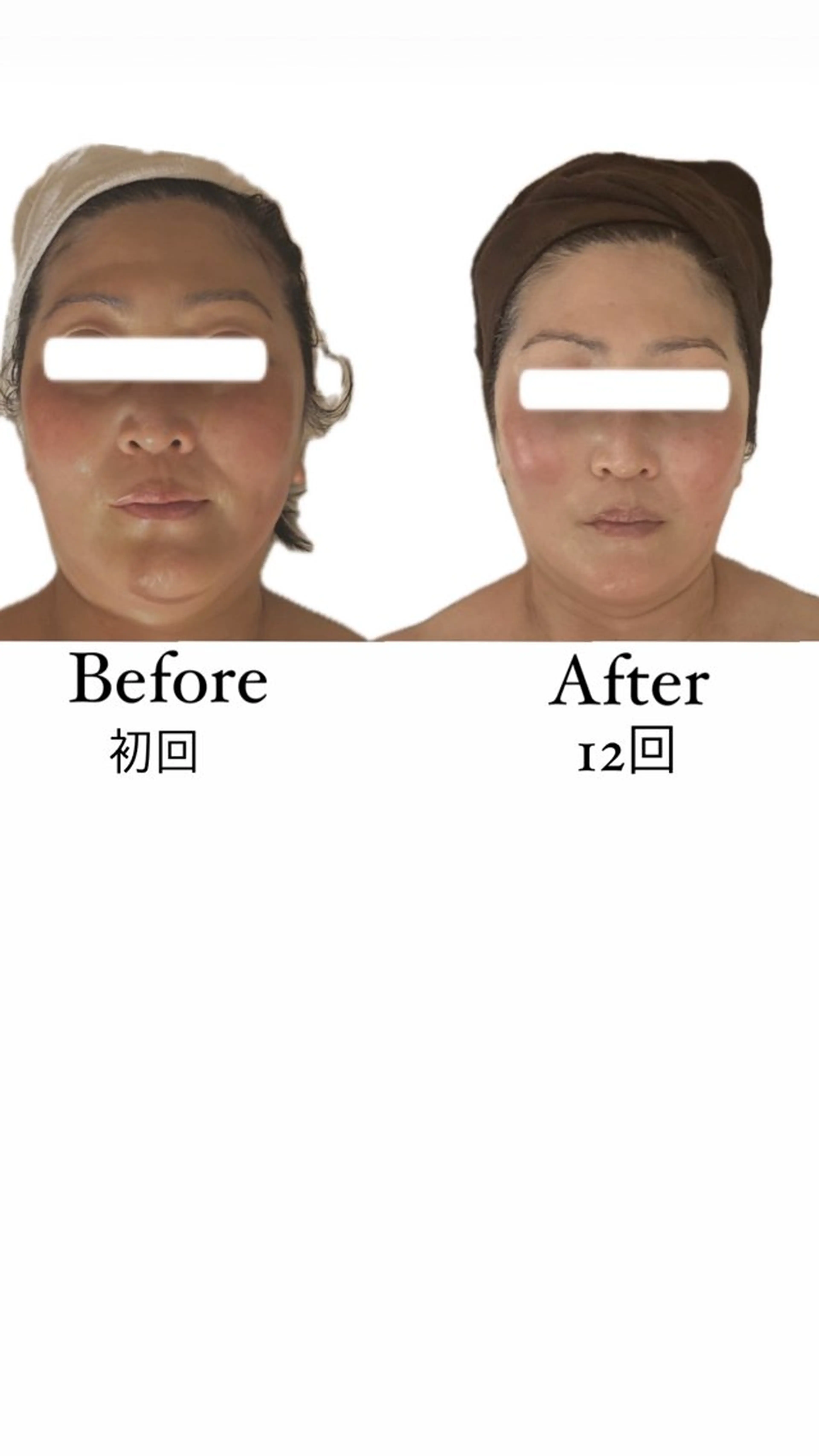 Bon glanzのエステ・リラクイメージ