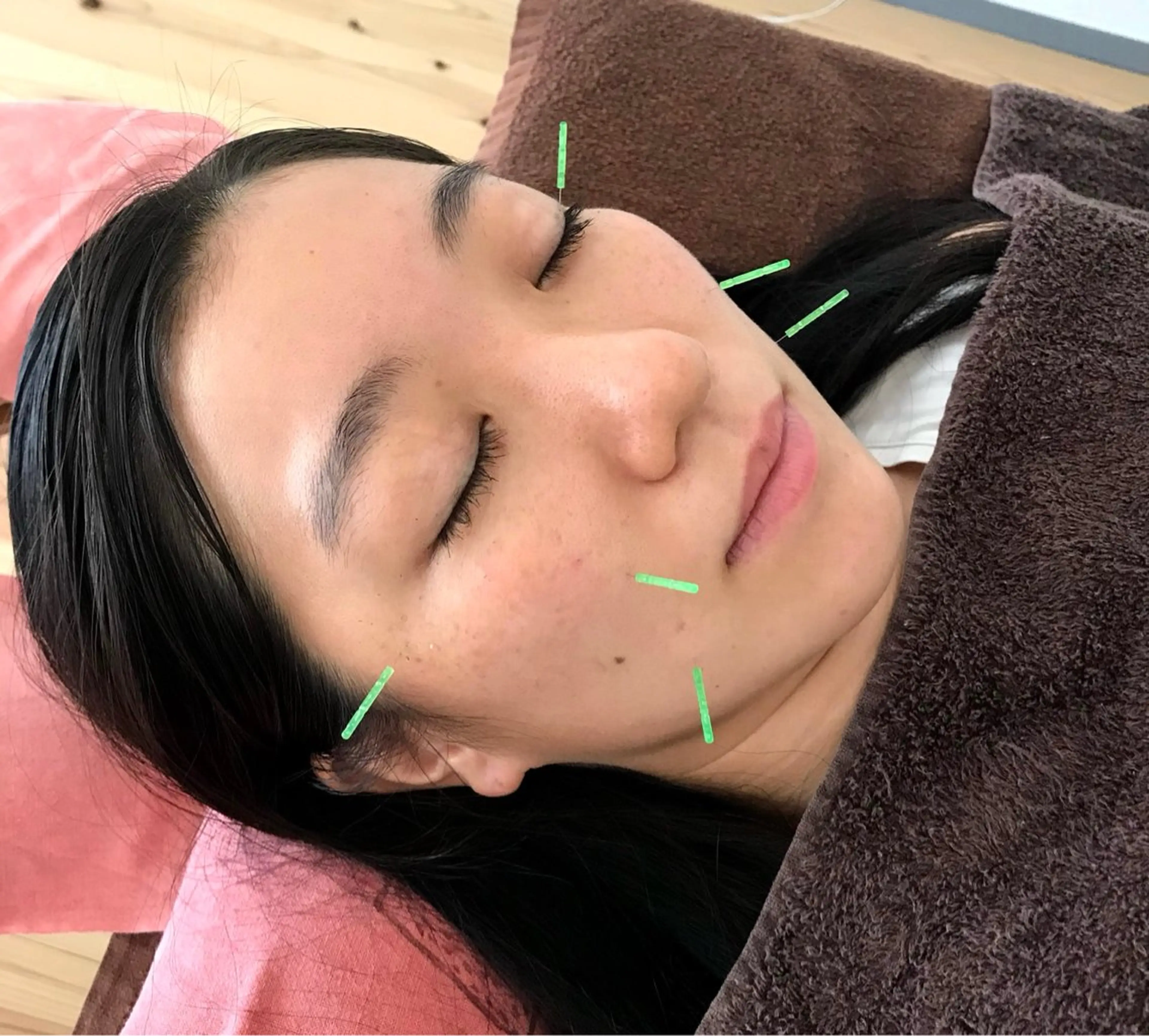 リラク そとやまのはり おきゅう所属・外山 勝敏のエステ・リラクイメージ