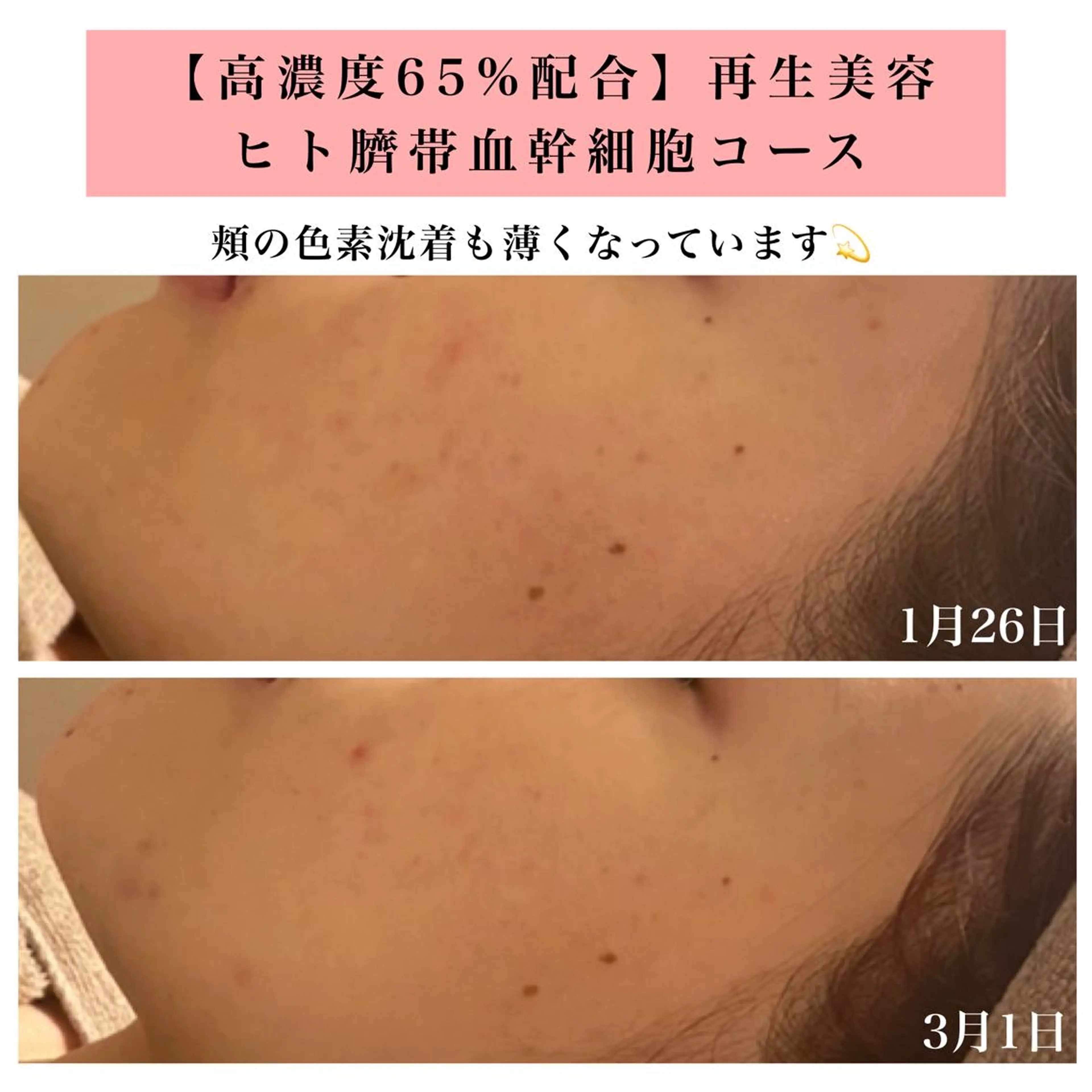 エステ リラク Bellesthe （ベルエステ）のエステ・リラクイメージ