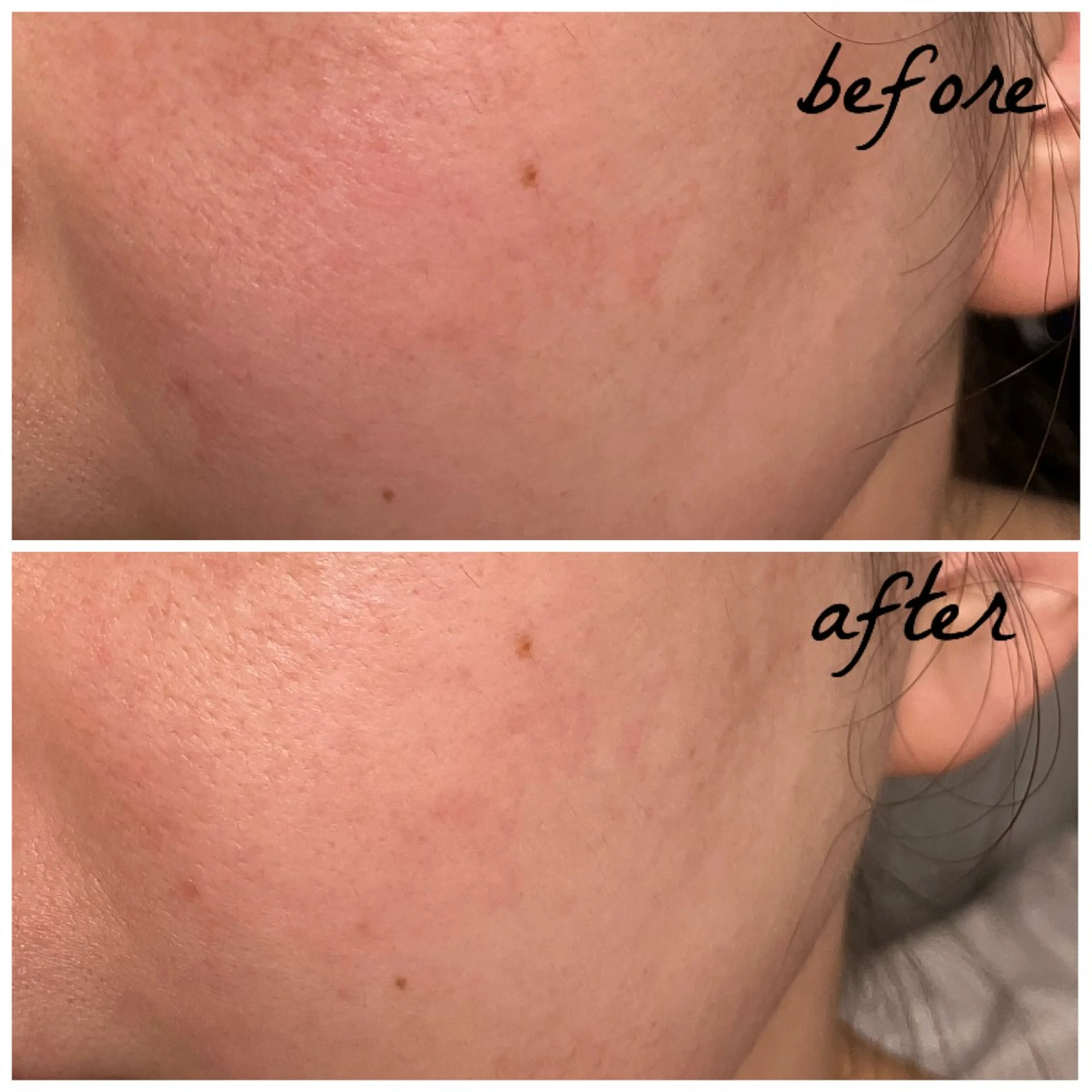 メンズ エステ メナード岐阜茜部 杉浦のエステ・リラクイメージ