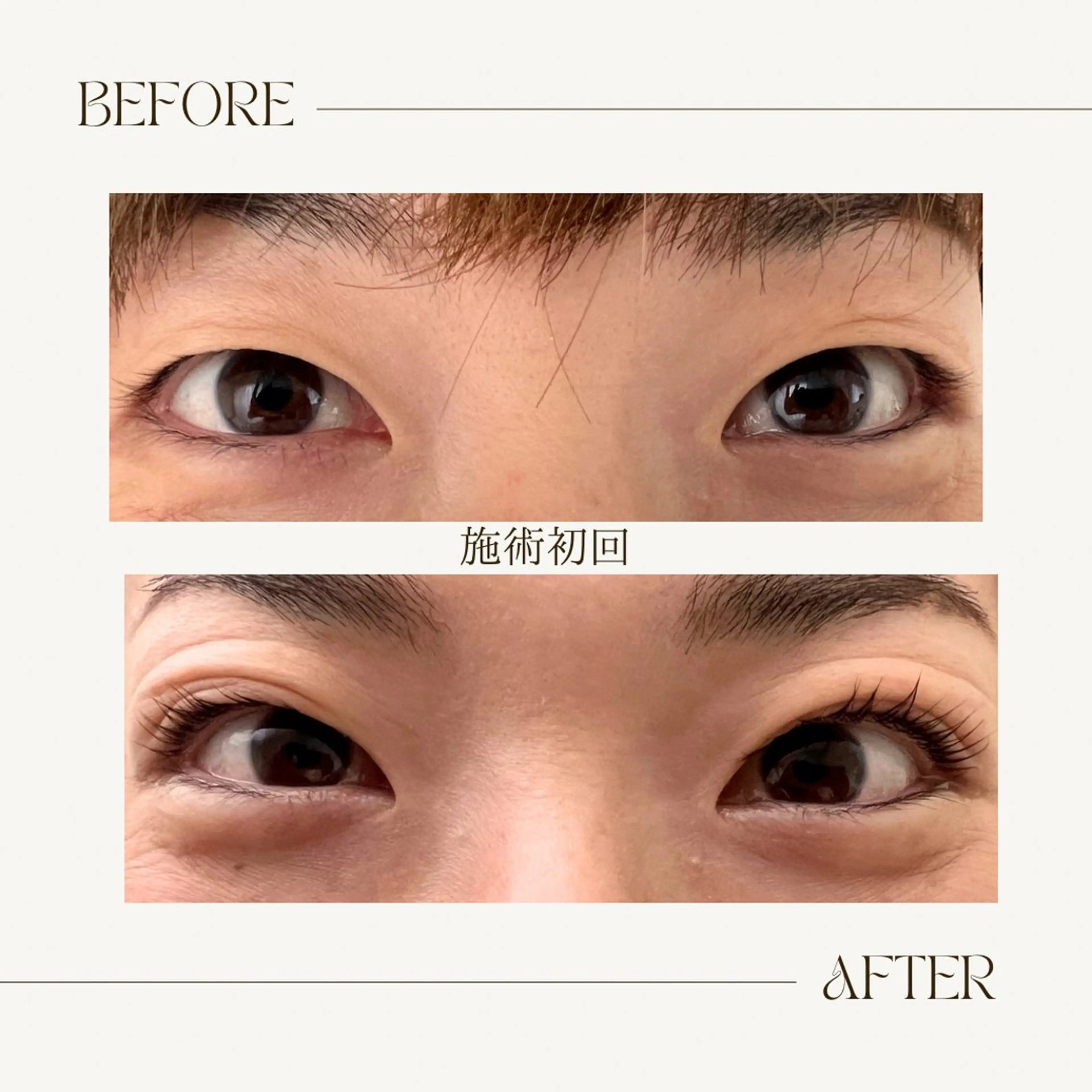 マツエク・マツパ 一重×まつ毛パーマ マツパ marble所属・marble marbleのマツエク・マツパデザイン