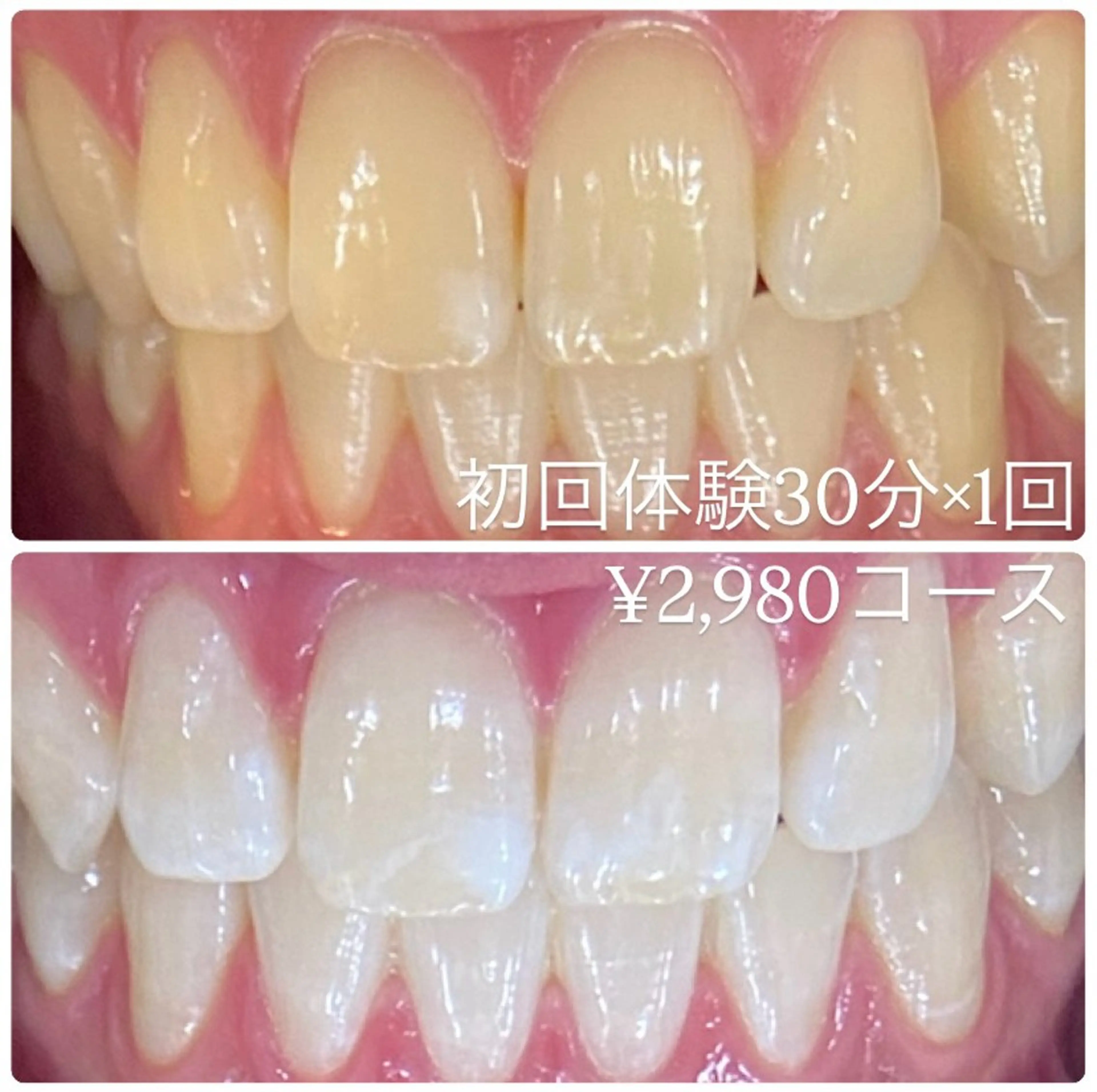 PLATINUM Beauty 横浜店所属・ホワイトニングルーム 横浜店のその他イメージ