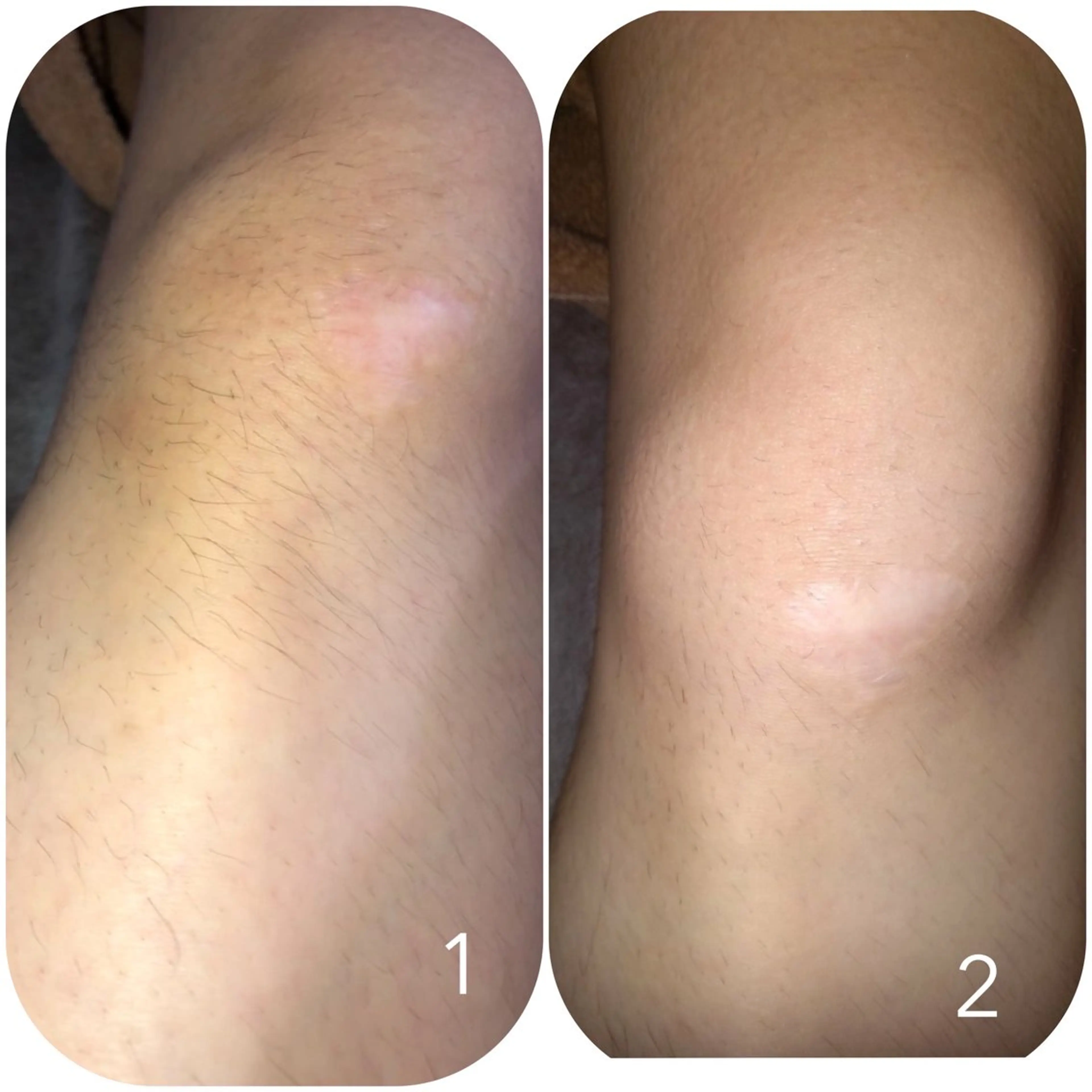 Laule'a ラウレアのエステ・リラクイメージ