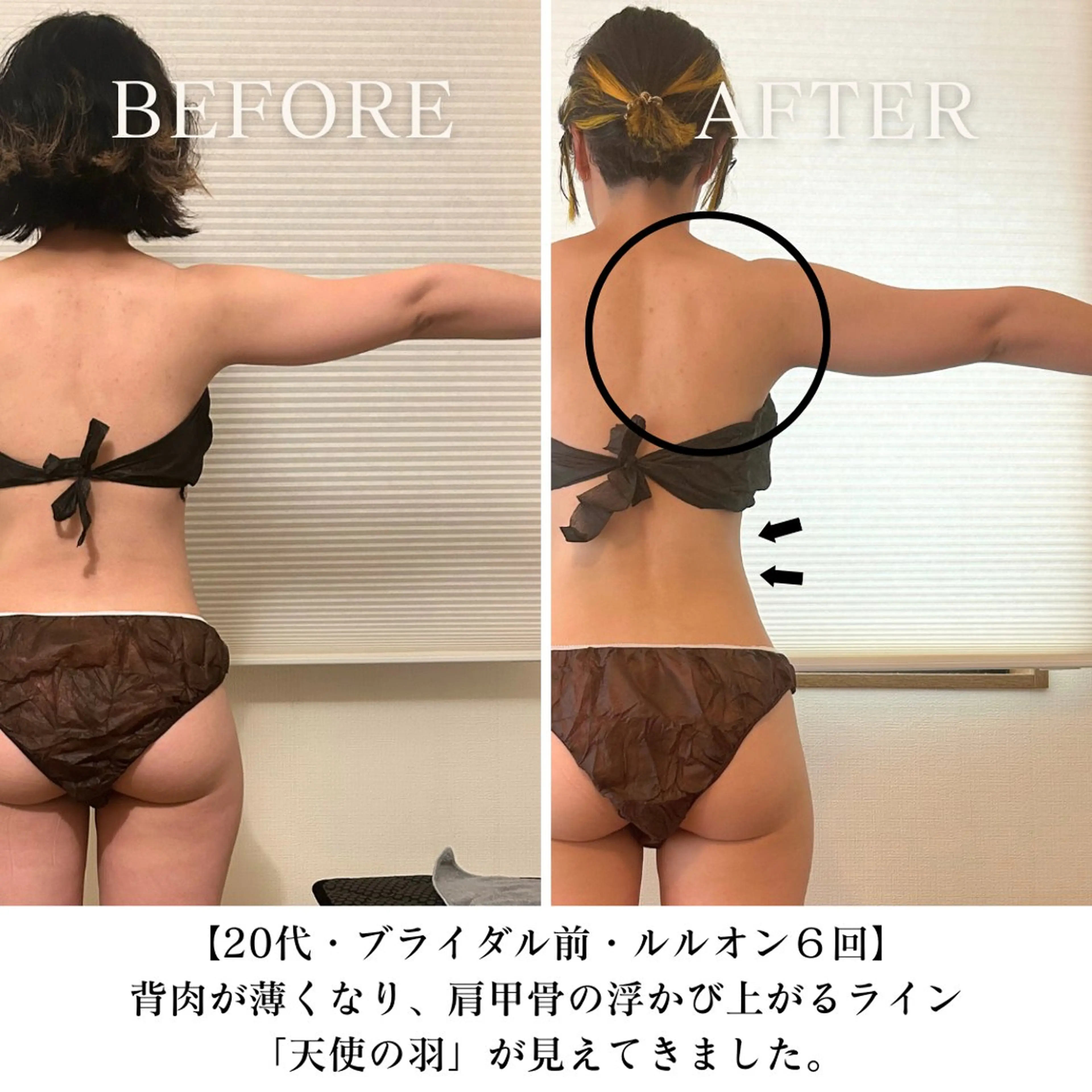 【ブライダル】LULUONN＋背中・腕集中してマッサージ♪NMN高濃度パック¥8800→¥7800の写真