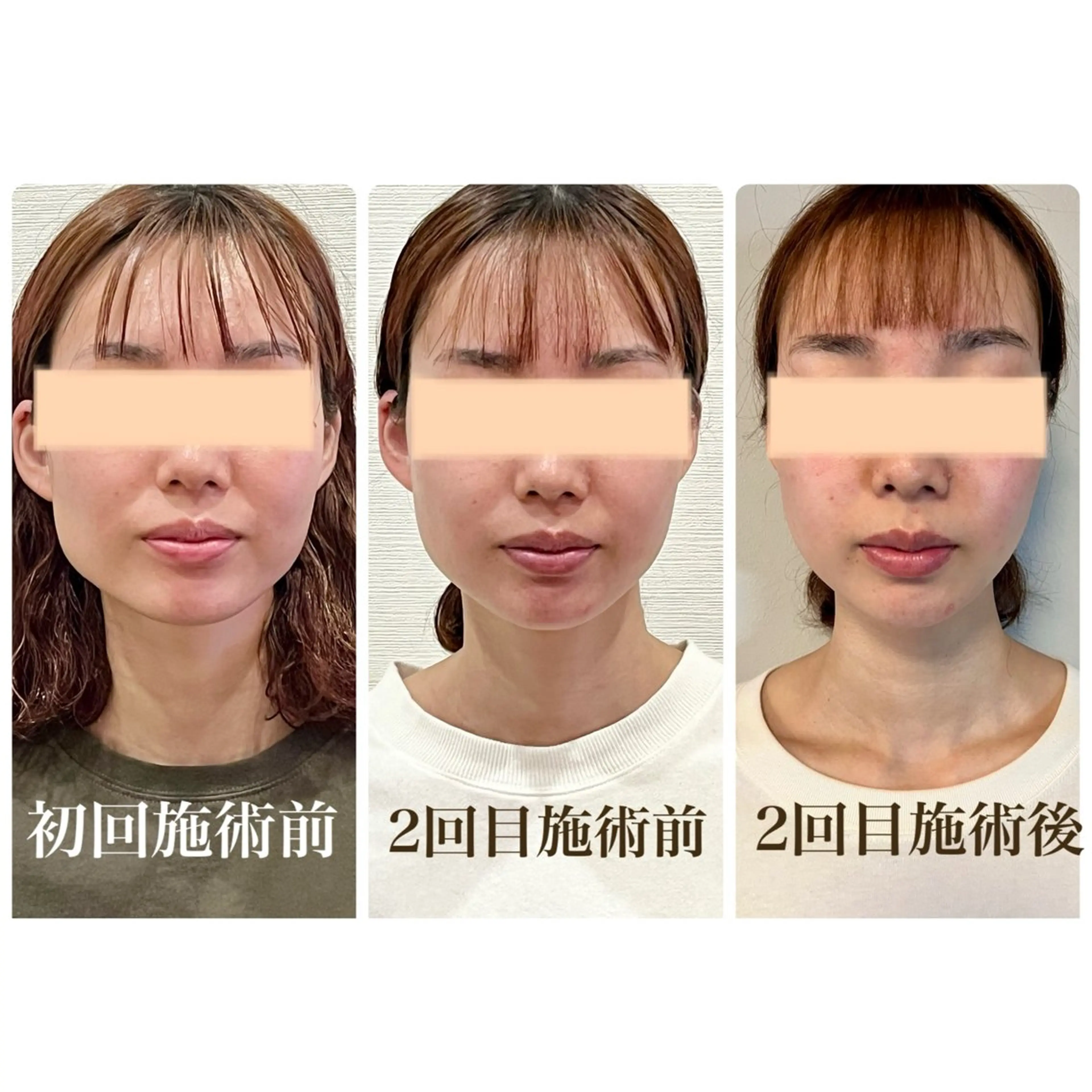 Cream 福井のエステ・リラクイメージ