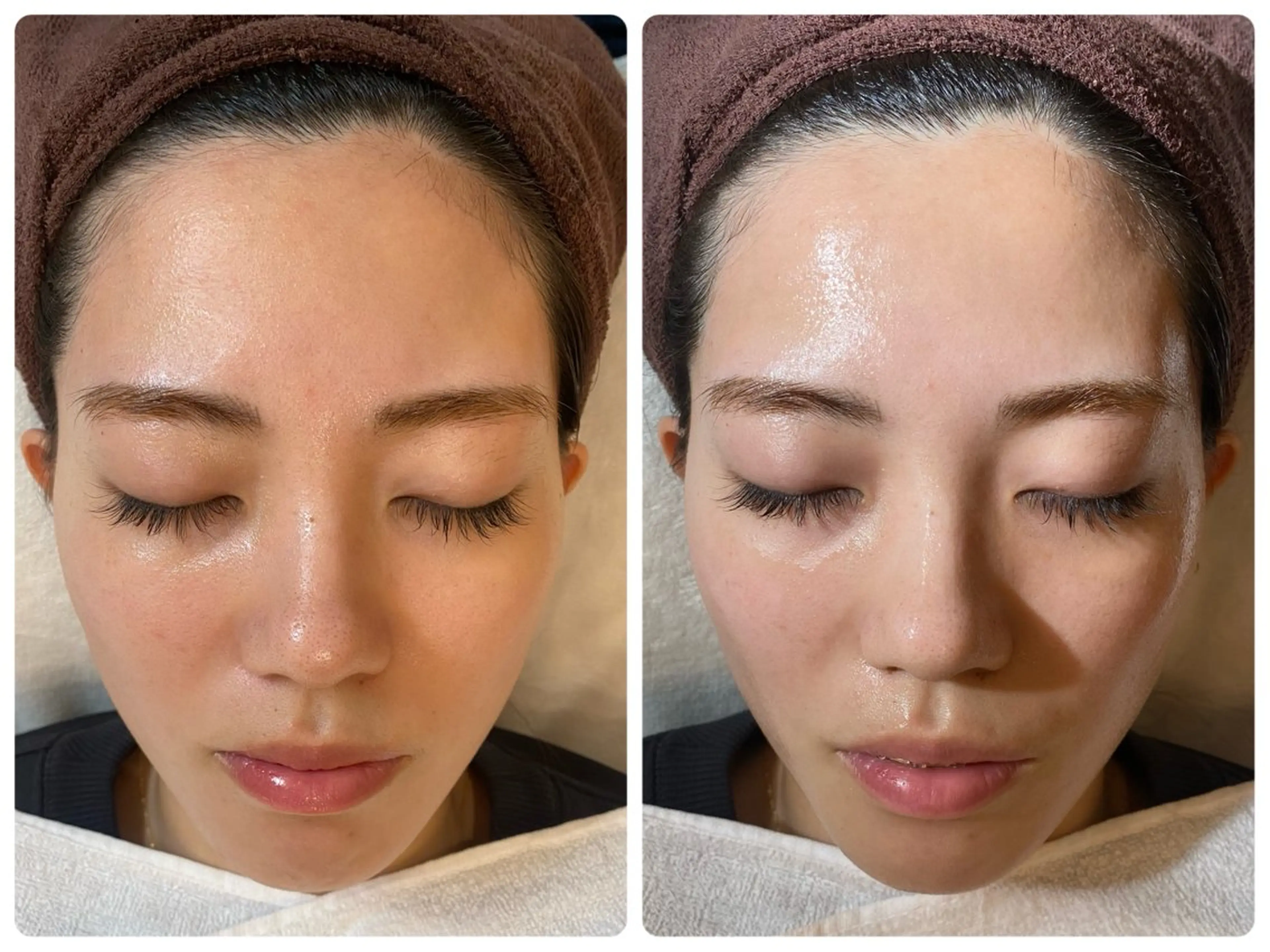 ハーブピーリング🌿 脱毛🧡ヘッドスパのエステ・リラクイメージ