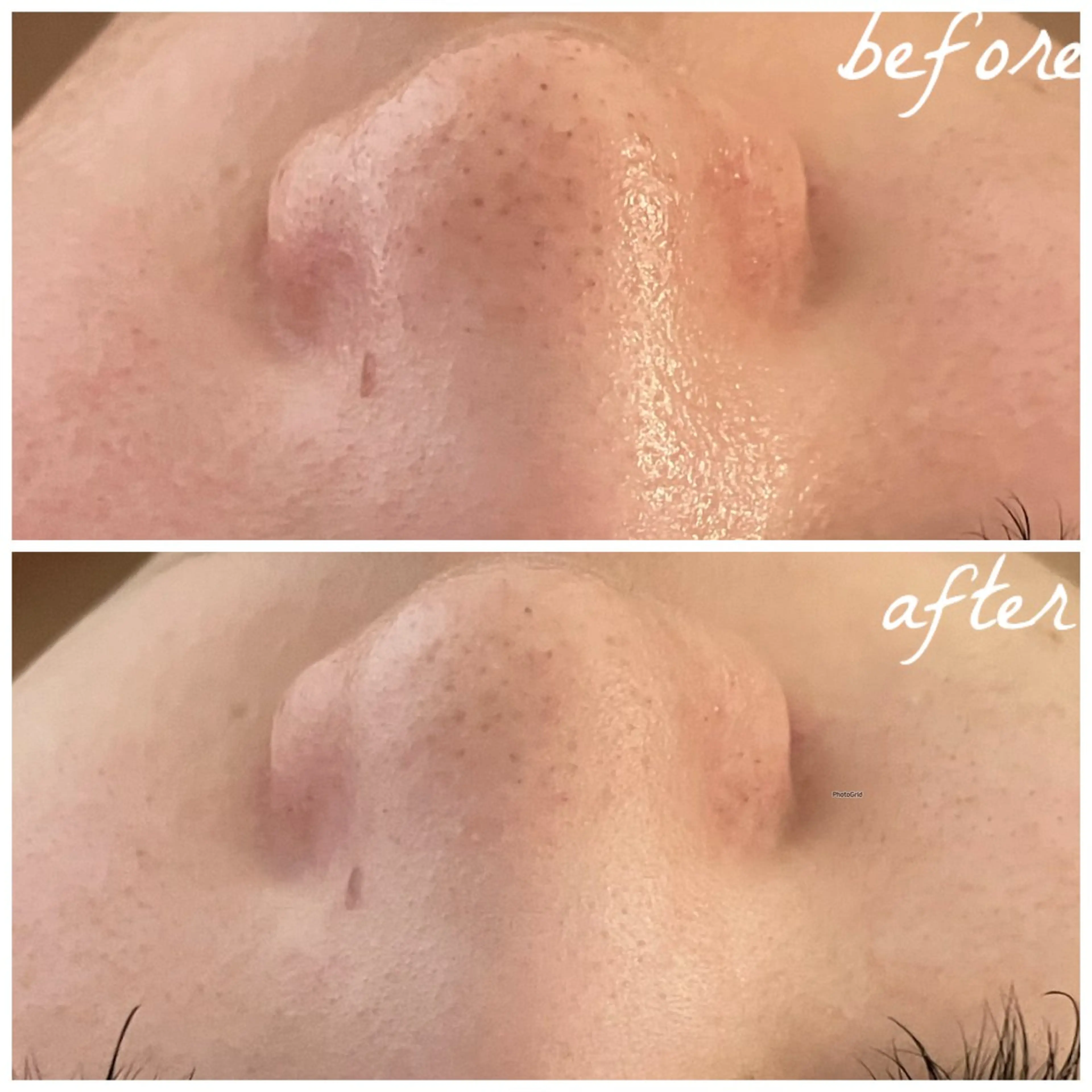 メンズ エステ メナード岐阜茜部 杉浦のエステ・リラクイメージ