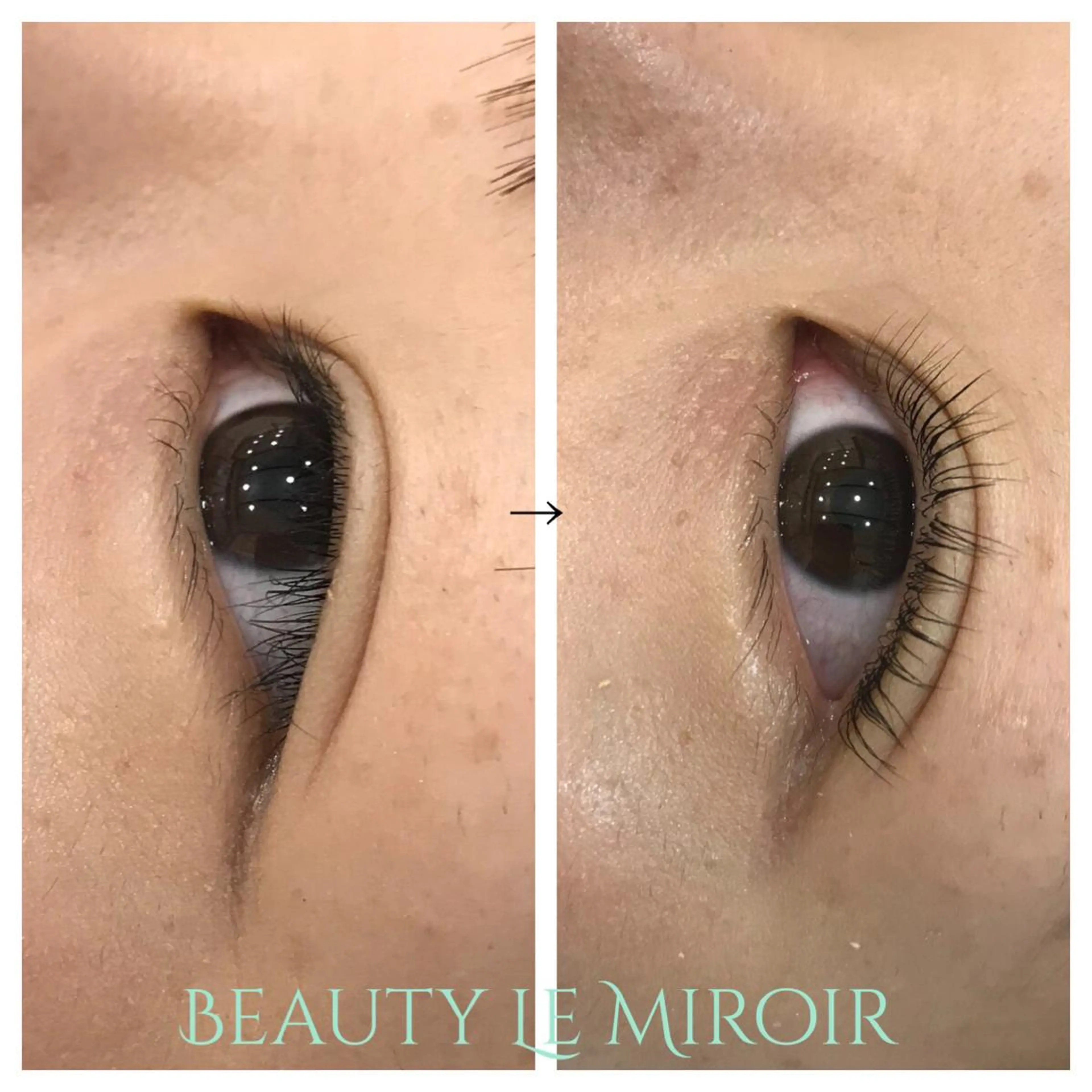 マツエク・マツパ ビューティー ミロワールのエステ・リラクイメージ