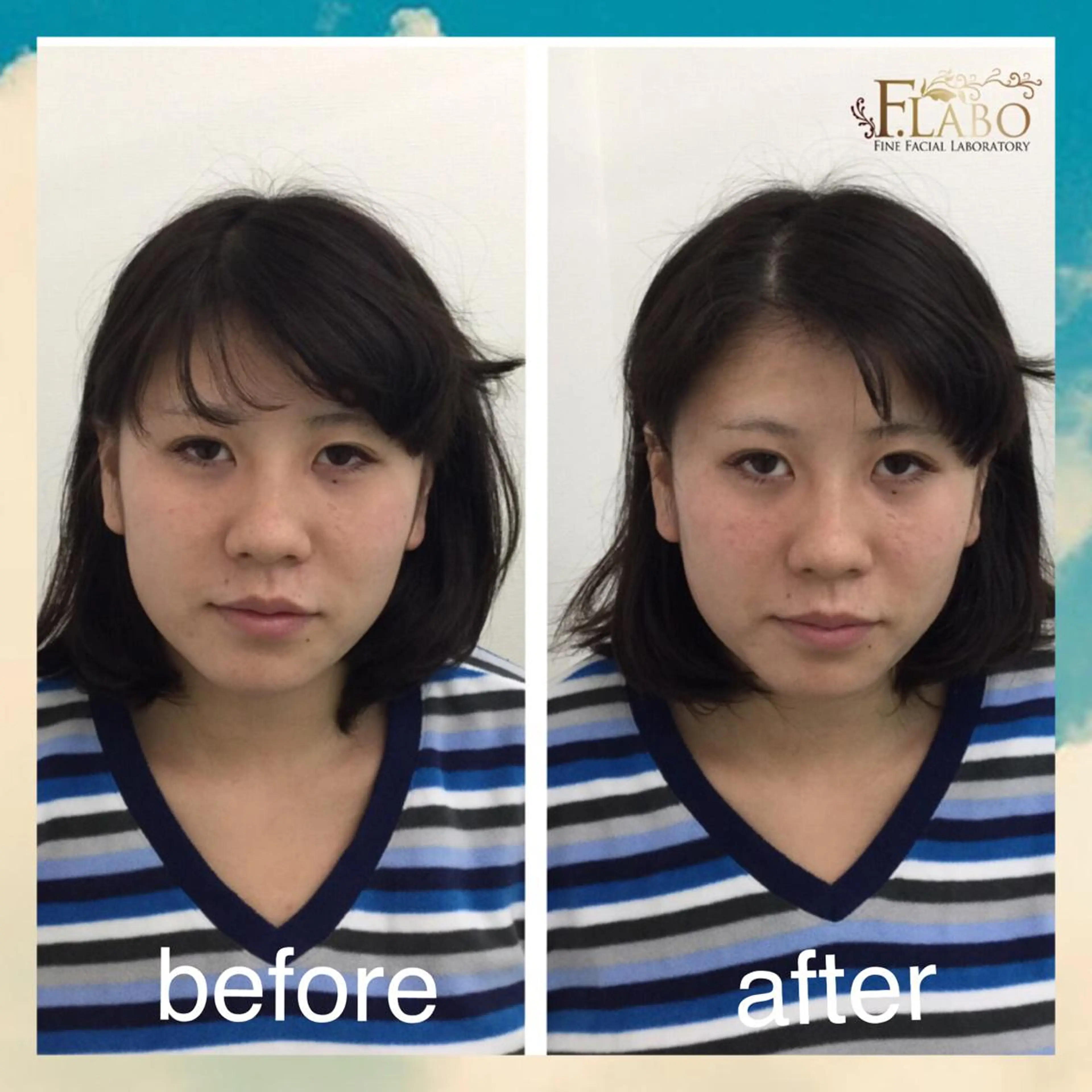 小顔&ダイエットジム エステ担当REIKOのその他イメージ