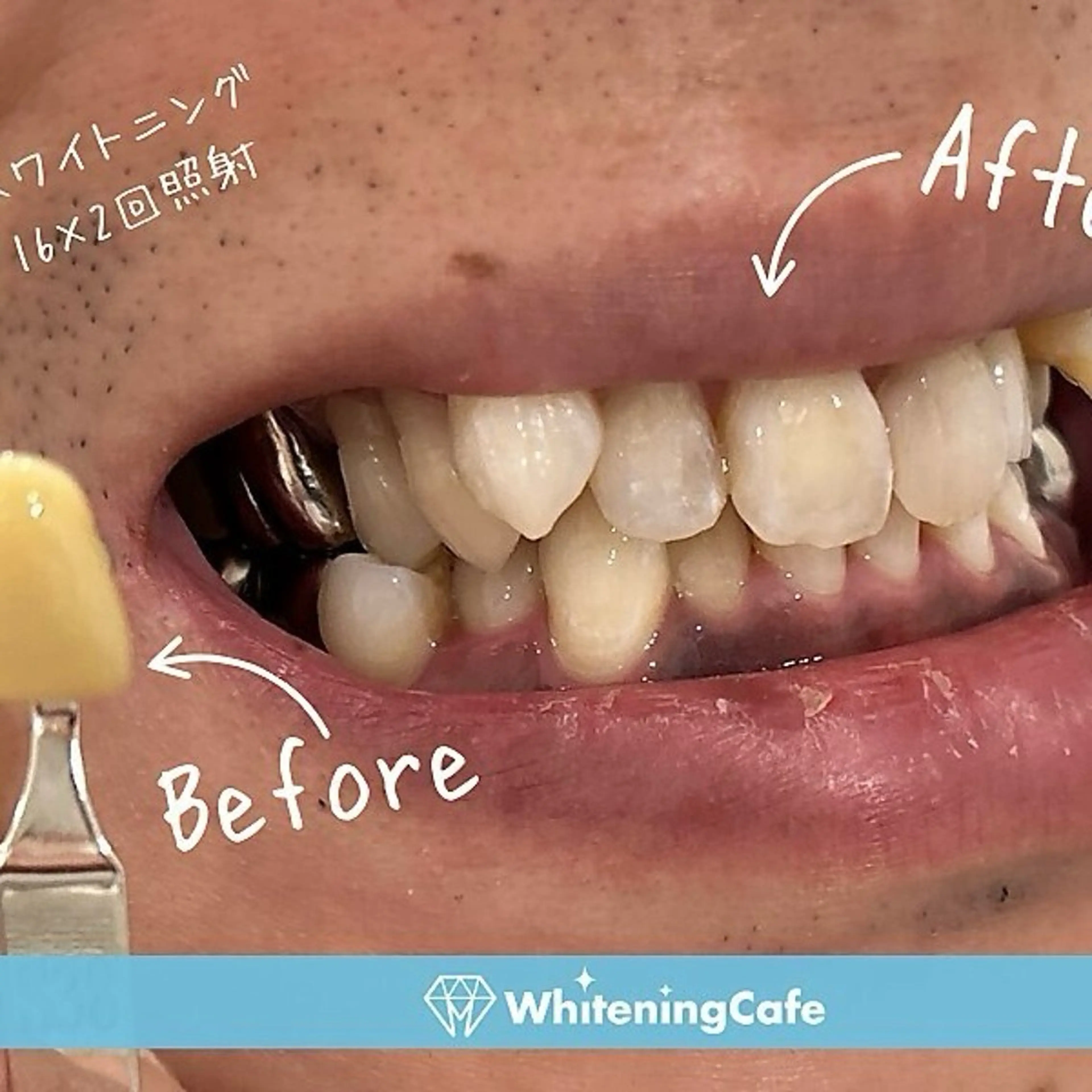 ホワイトニングカフェ神戸元町店所属・ホワイトニングカフェ 神戸元町店のエステ・リラクイメージ