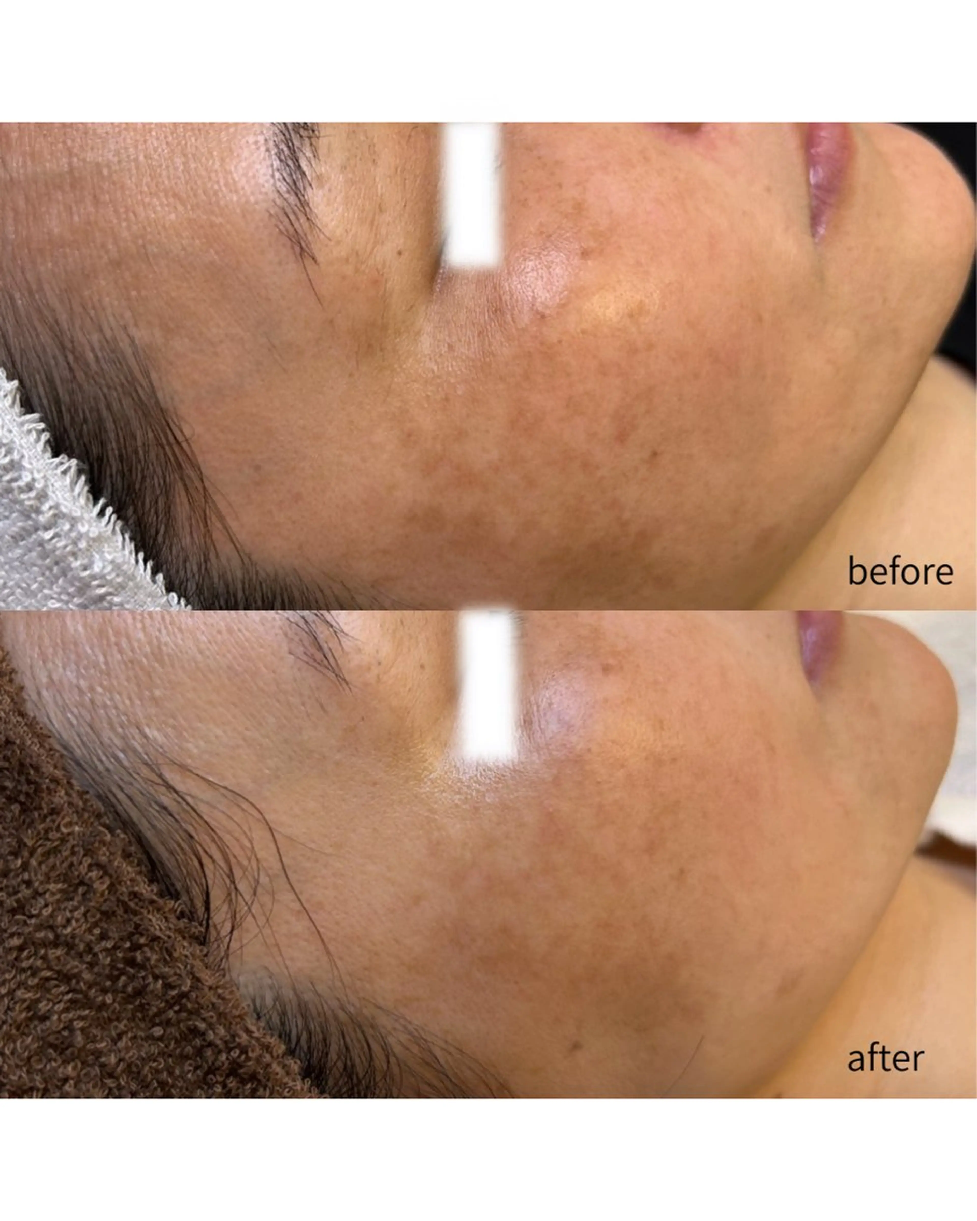 伊藤 稚菜のエステ・リラクイメージ