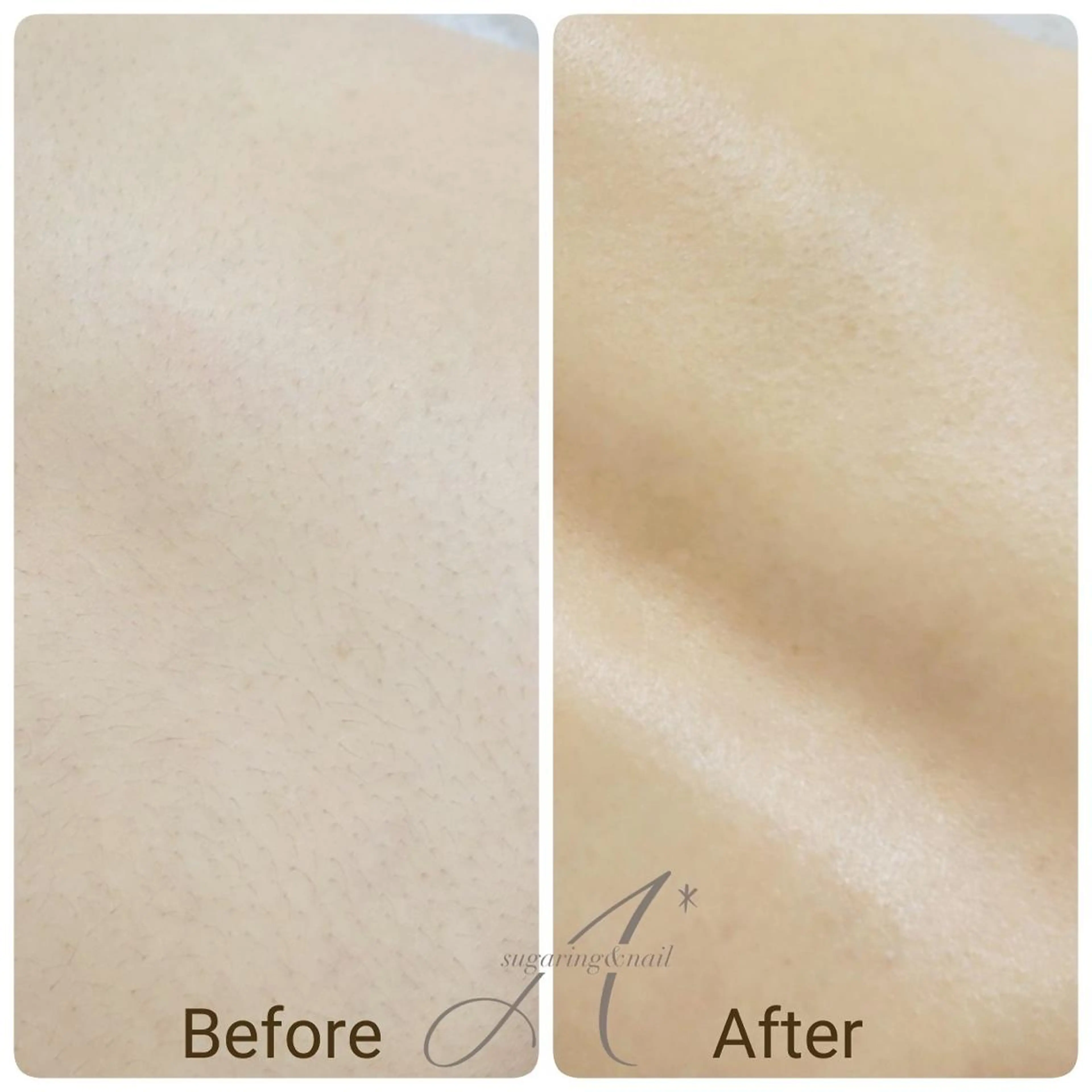 【A*エースター】 KARINのエステ・リラクイメージ