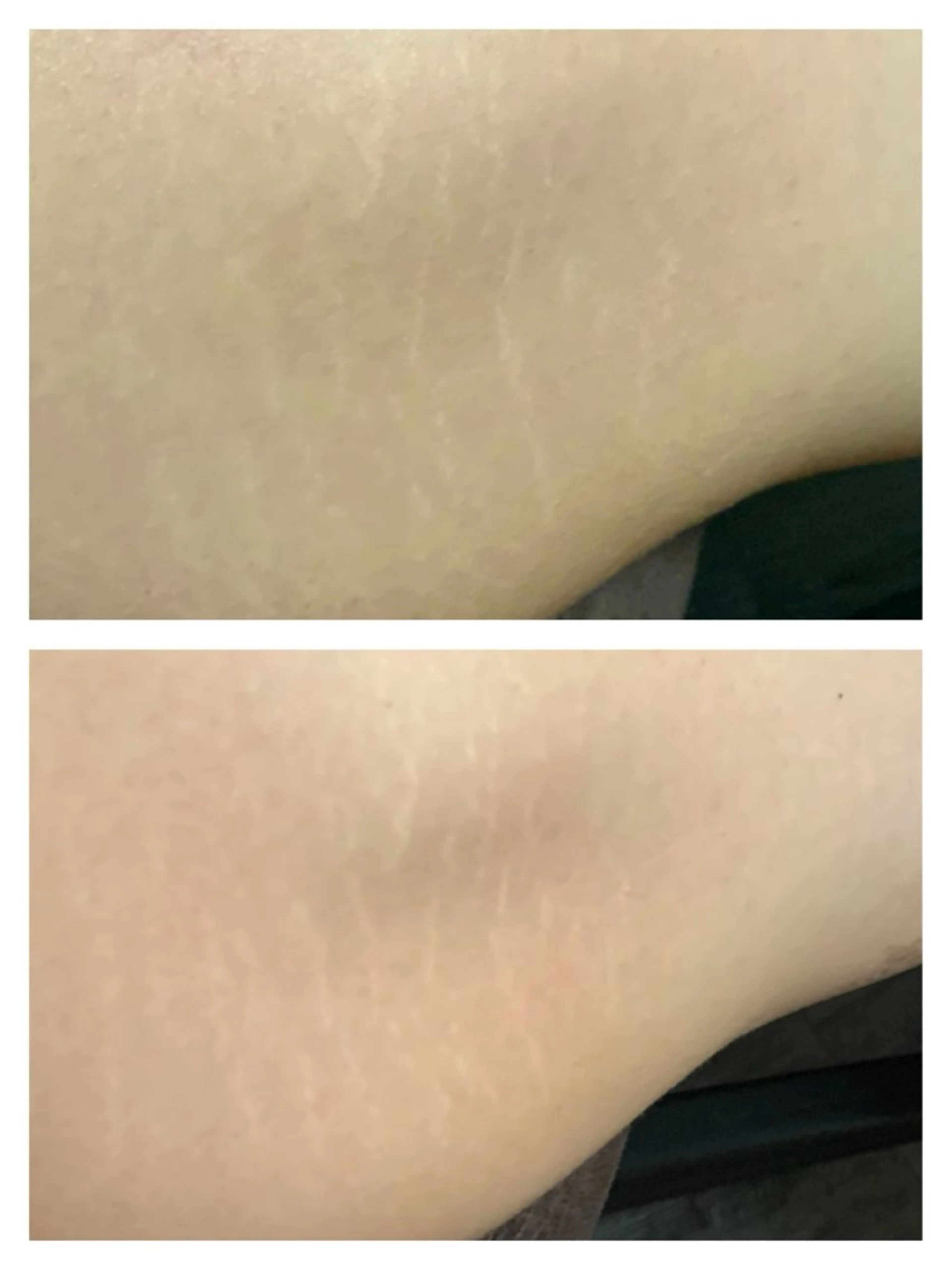 〜女性と母のための癒しサロン〜 Pua Welina所属・吉田 未優のエステ・リラクイメージ