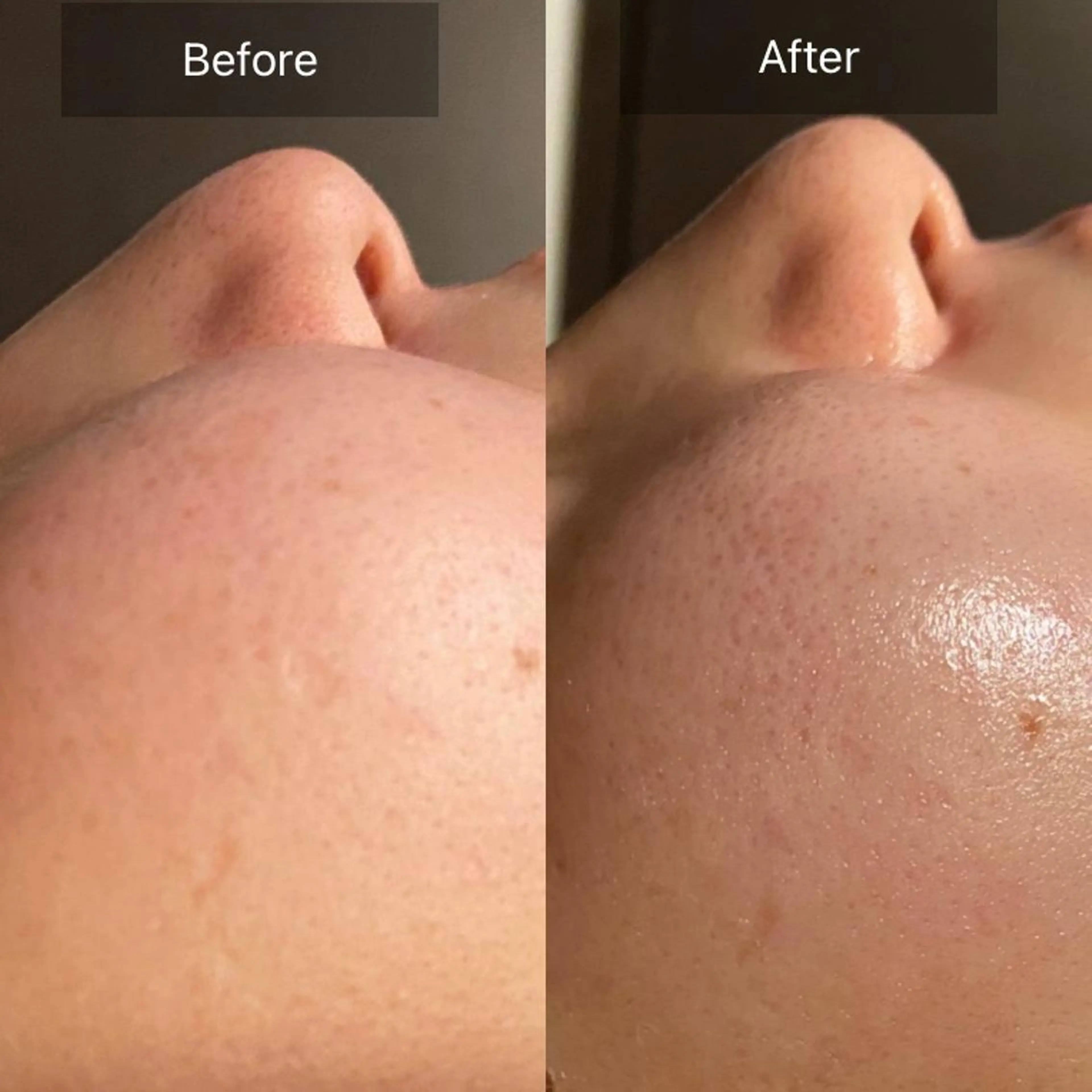 Mandarin Orange所属・毛穴から始める肌メン テマンダリンオレンジのエステ・リラクイメージ