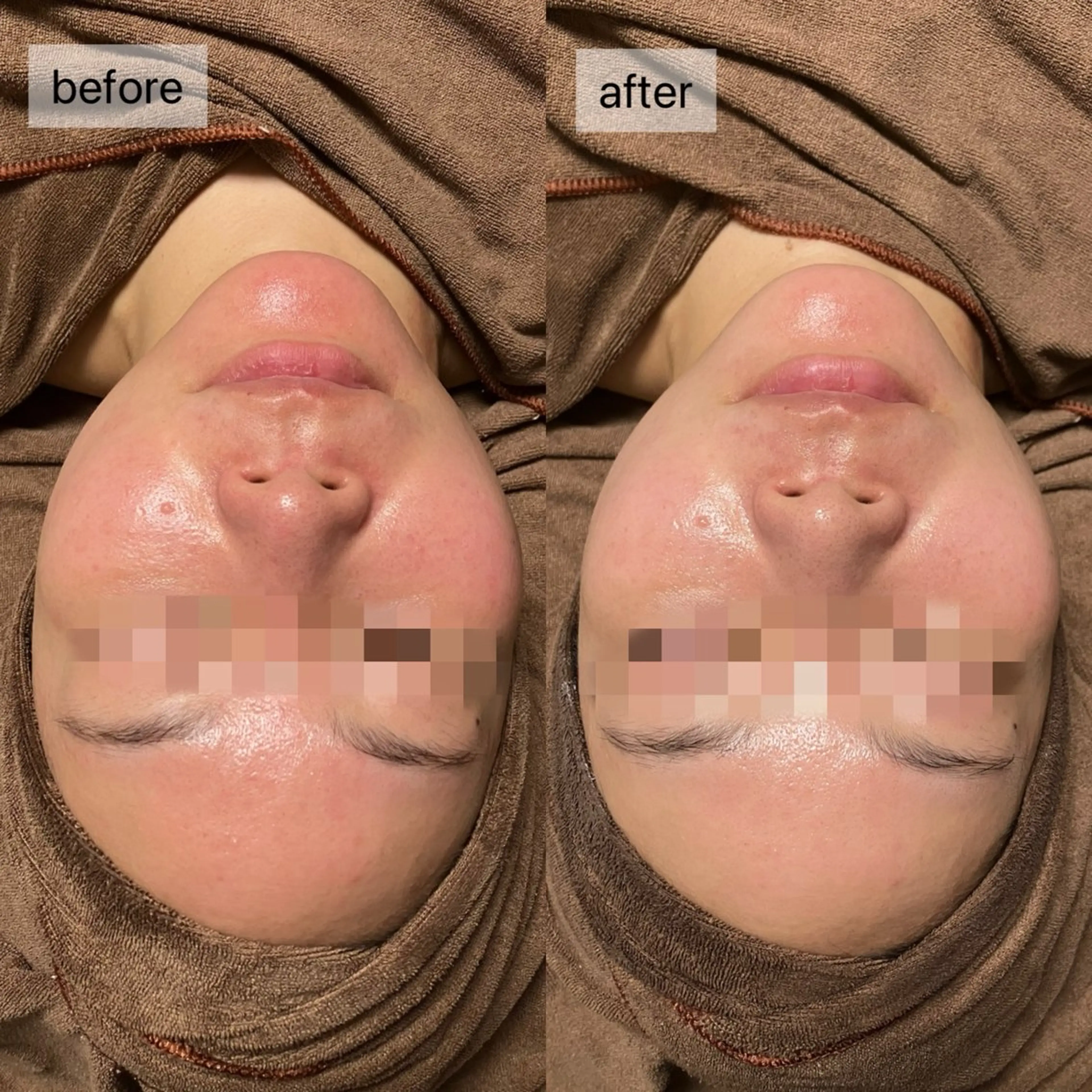 エステ HINANO矢場町店【ヒナノ】所属・脱毛/肌改善🌿 HINANO 村田のエステ・リラクイメージ