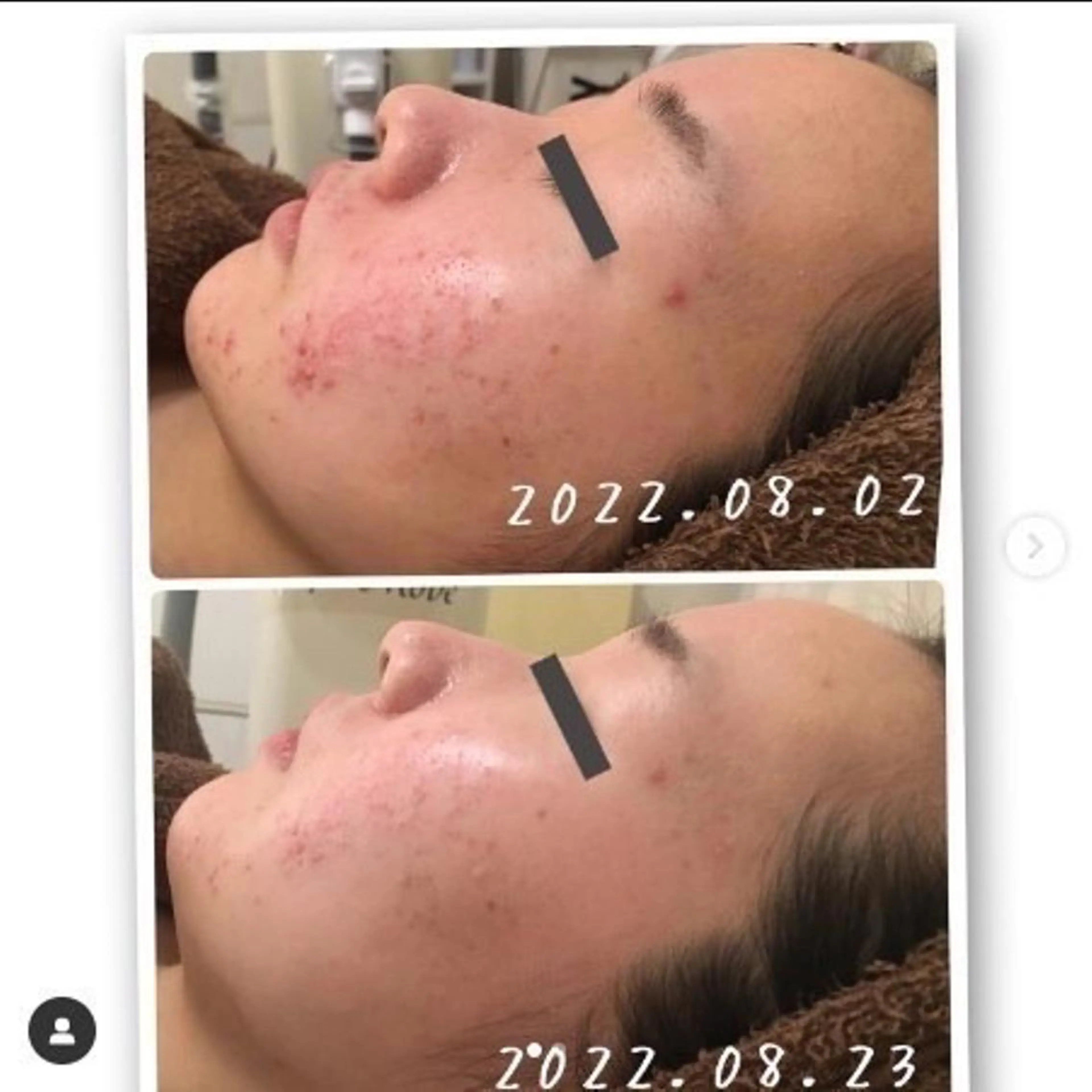 アルカンジュ~archange~所属・痩身/毛穴洗浄/脱毛 アルカンジュのエステ・リラクイメージ