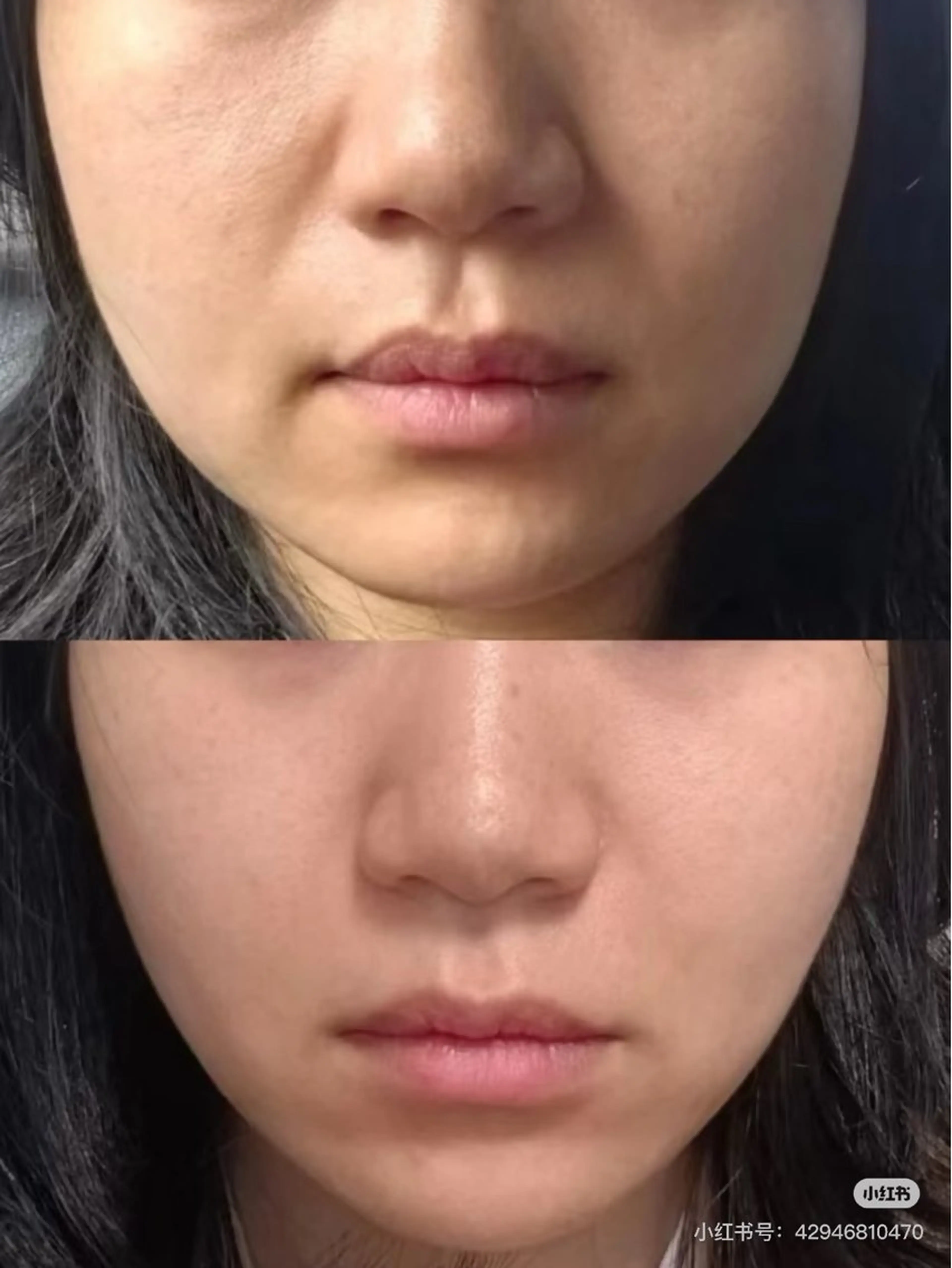 ショート エステ aliaハイフ&水光ジェットサロン所属・aliaハーブ水光店 エステティシャン募集のエステ・リラクイメージ