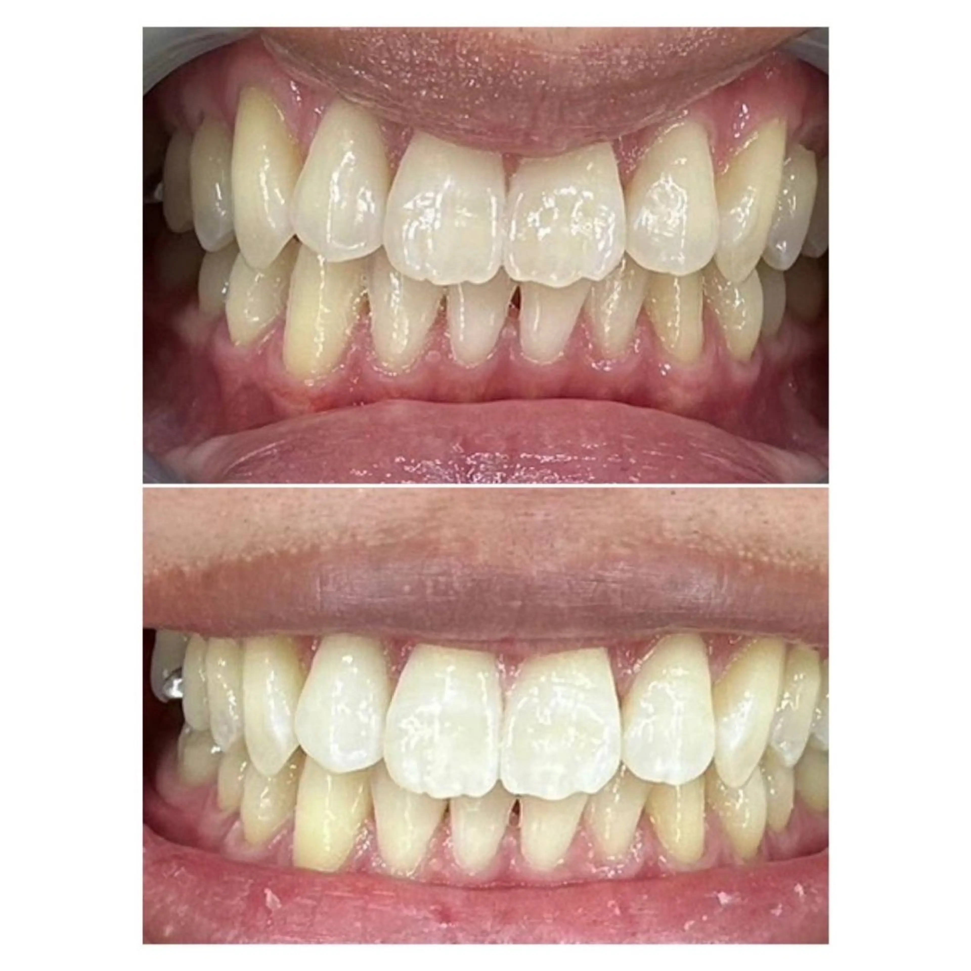 MBEAUTYSALON 千葉店・京成大久保所属・Melty 輝のその他イメージ