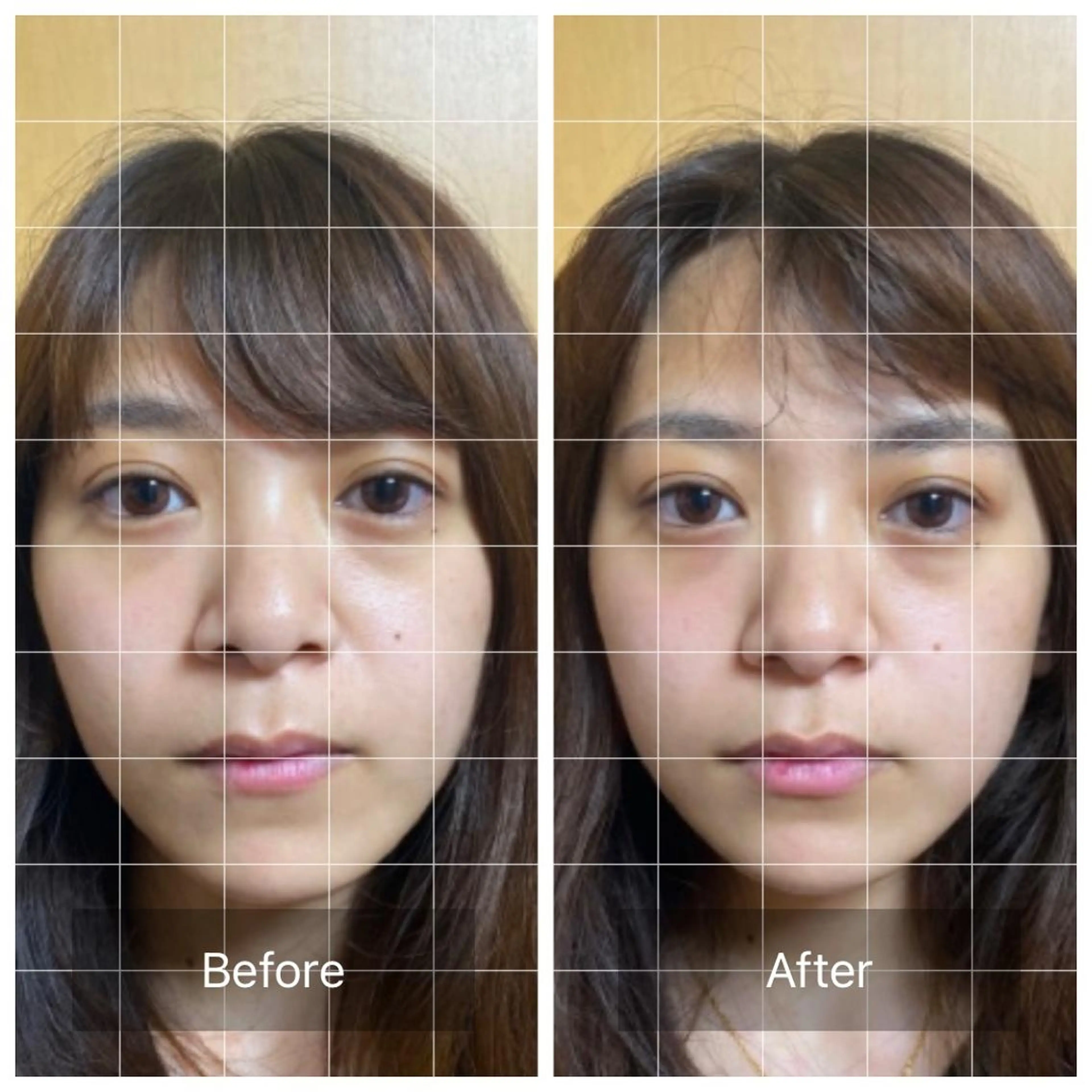 小顔整体の写真