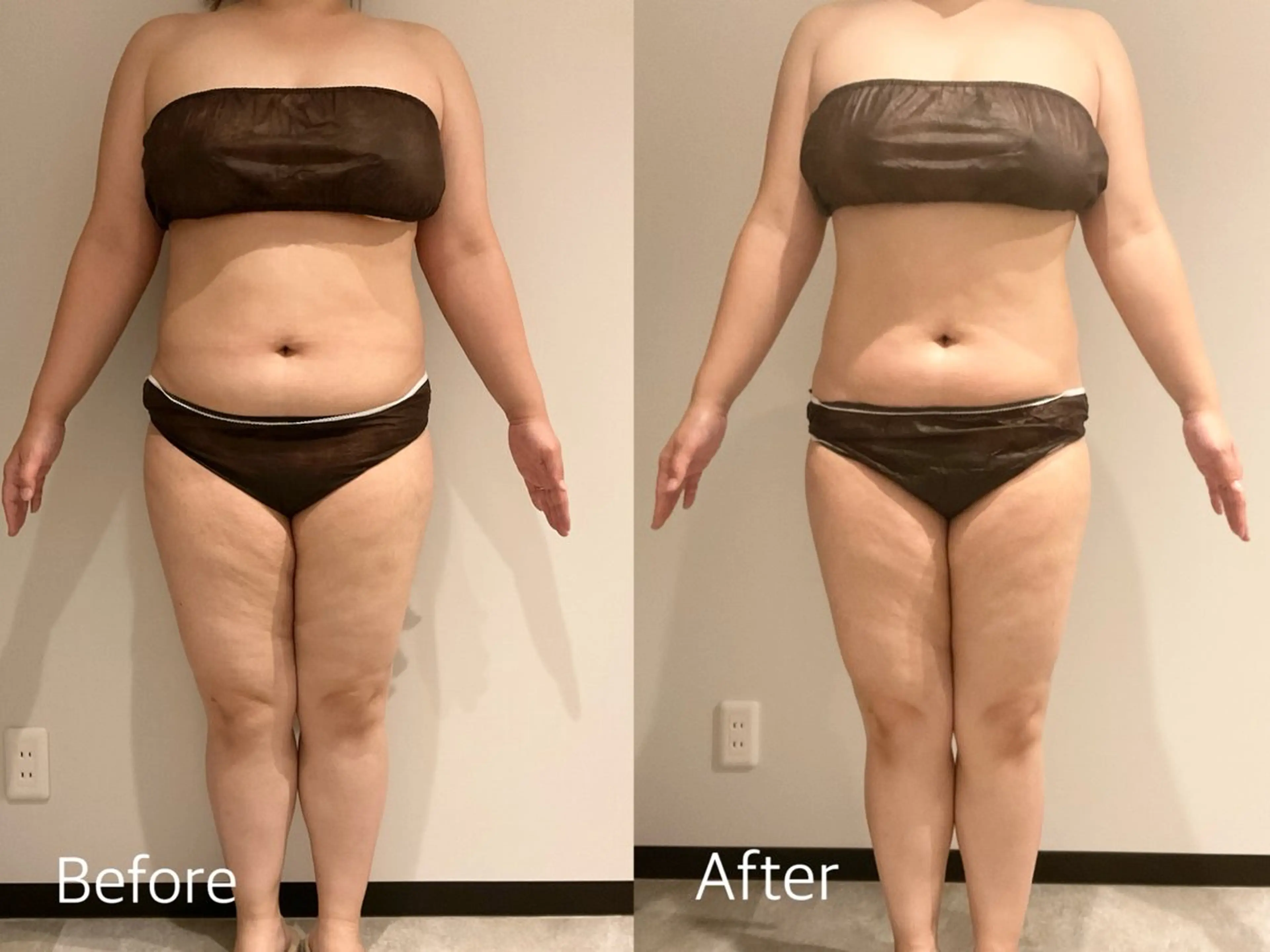 エステ リラク Esthetic MiEUXのエステ・リラクイメージ