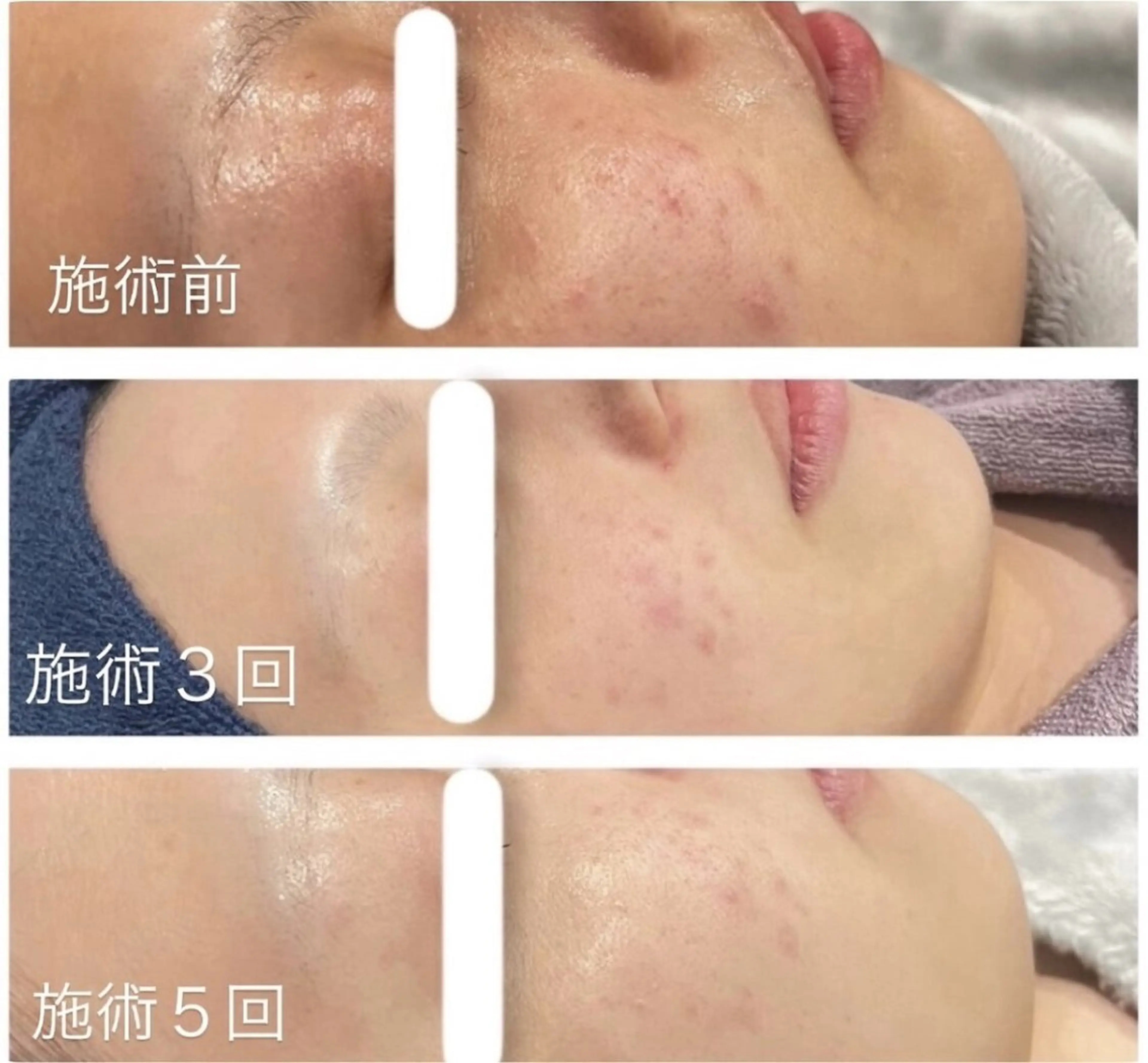 アンド ミルルのエステ・リラクイメージ