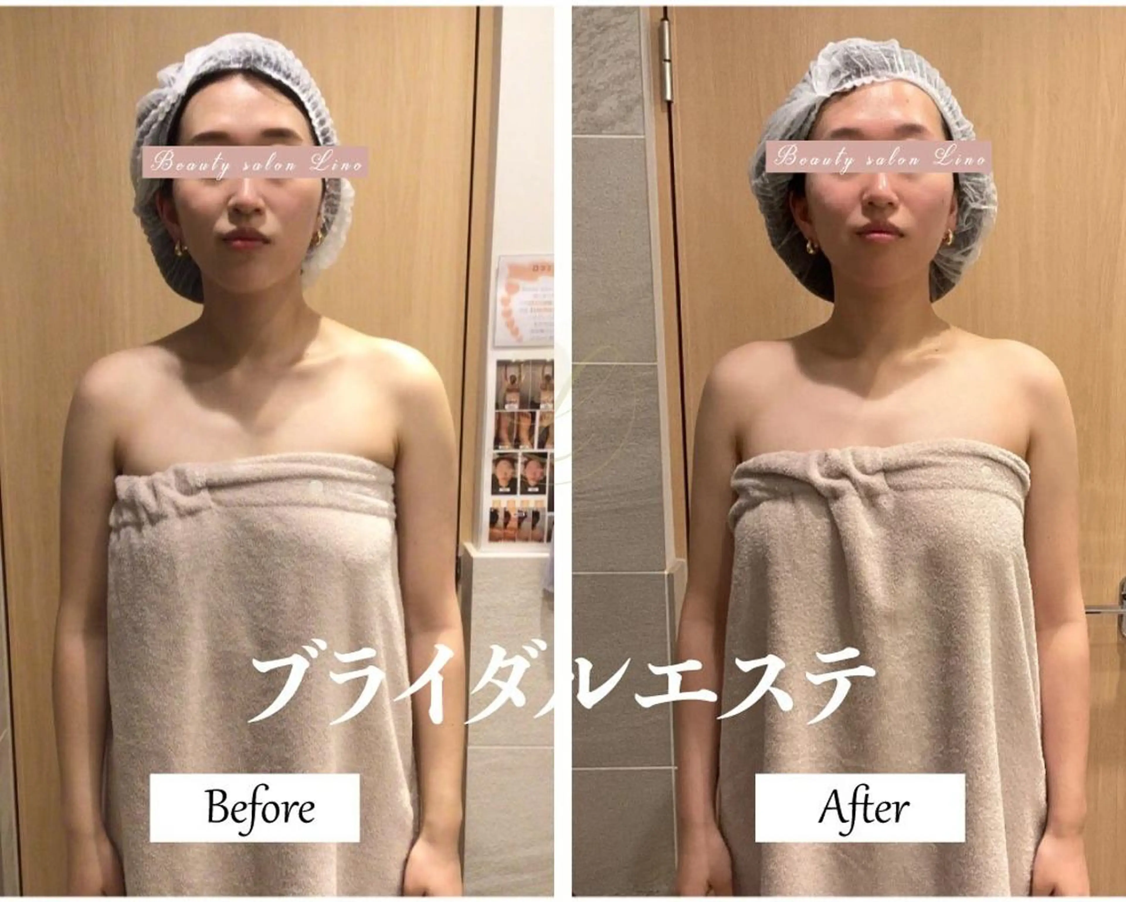 ブライダルサロン |Lino【堀江】のエステ・リラクイメージ