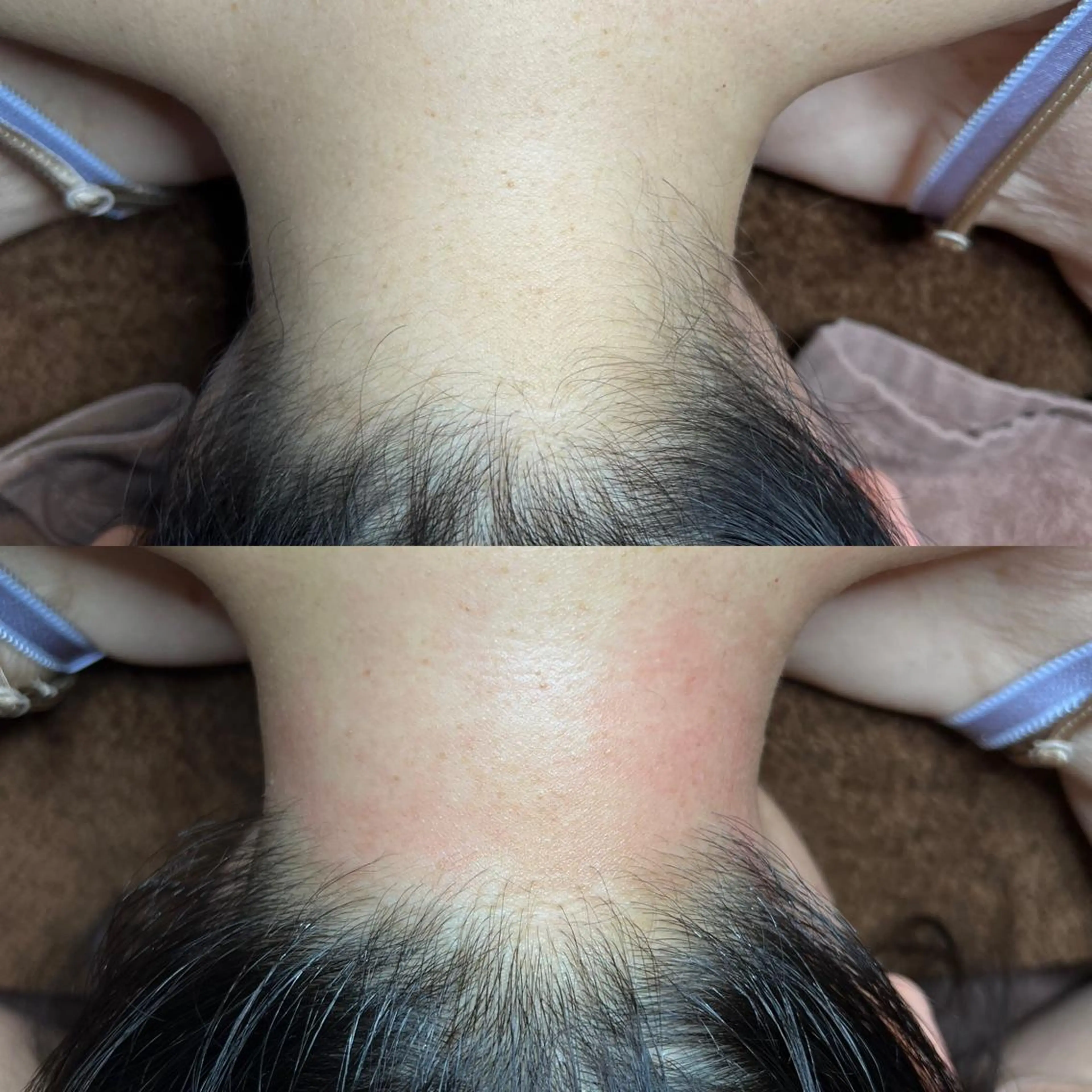 脱毛 GOLDEN AGE所属・GOLDEN AGEのエステ・リラクイメージ