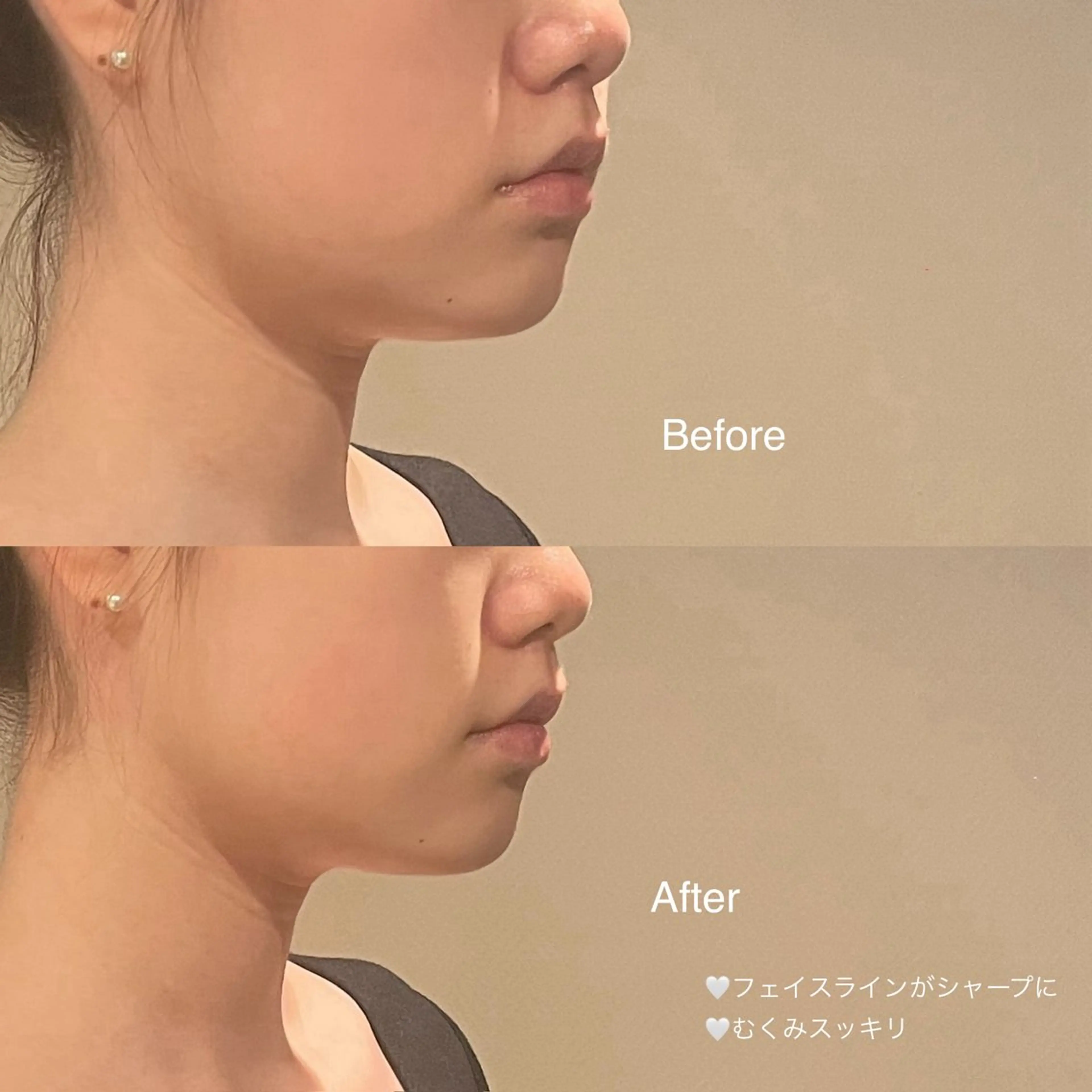 小顔•美容矯正Bholic所属・小顔・骨格矯正 Bholic 日本橋のエステ・リラクイメージ