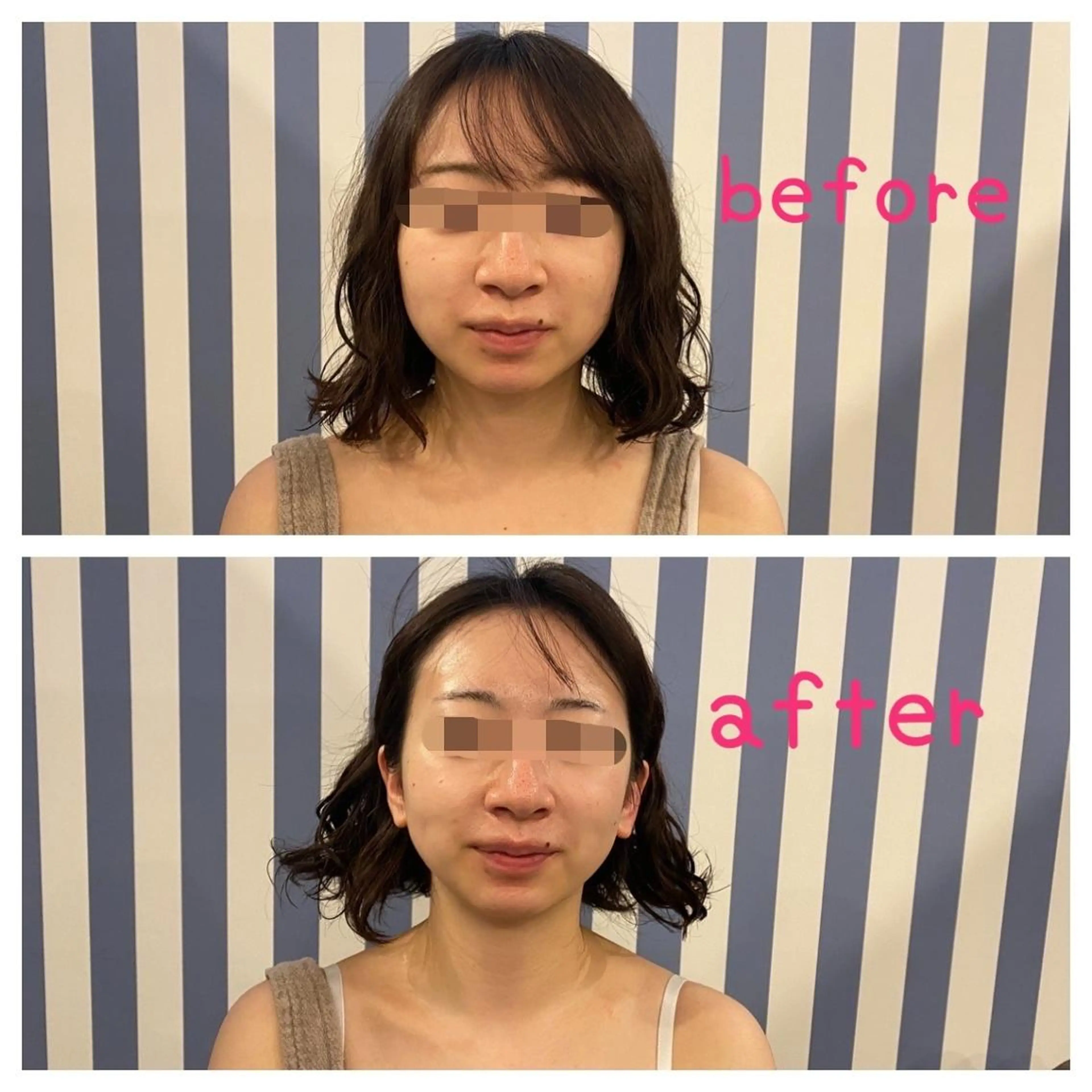 Eclat ALICEのその他イメージ