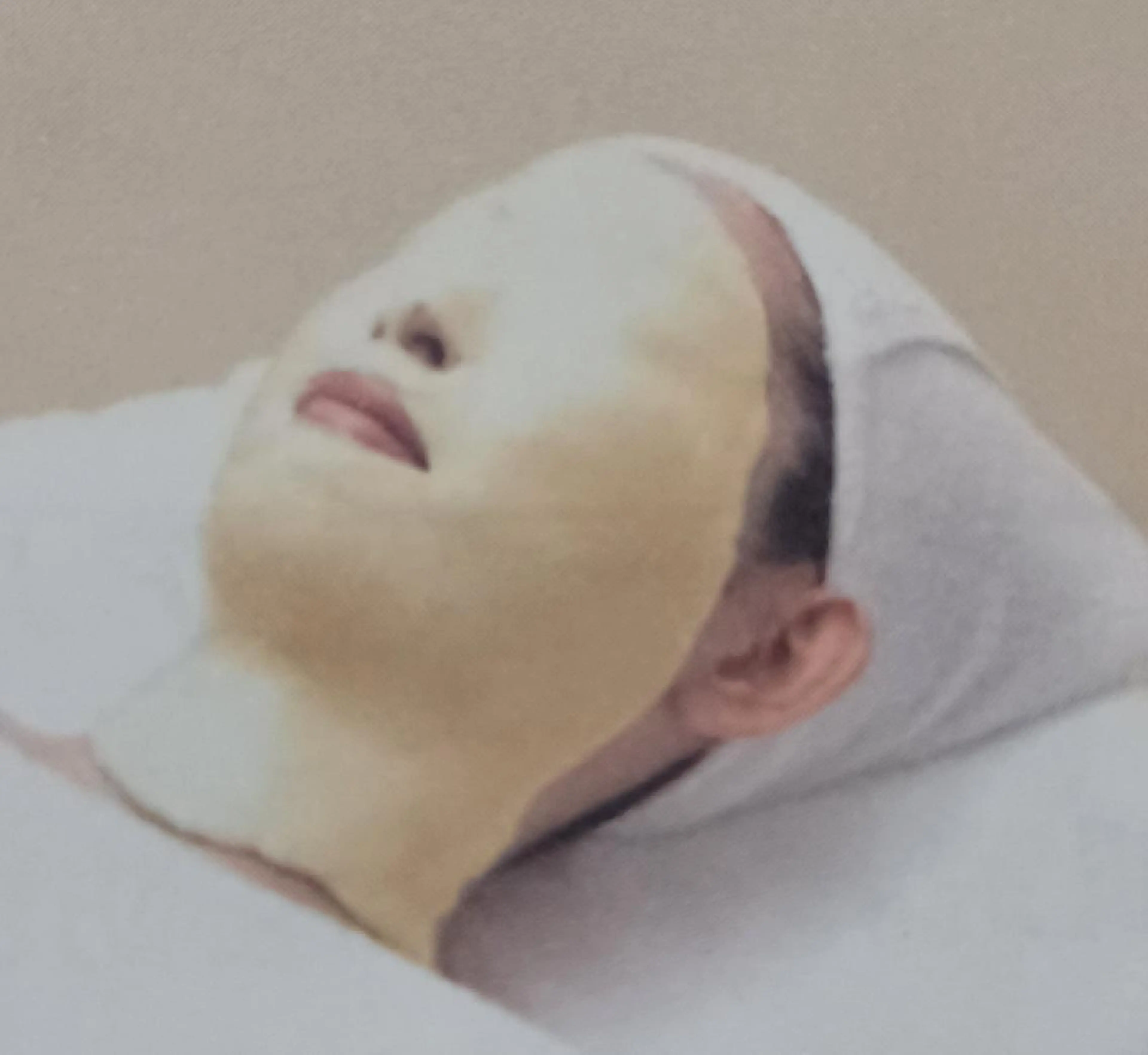 ⭐くすみのないお肌へ⭐🆕アドバンスコース+ダブルビタQパックの写真