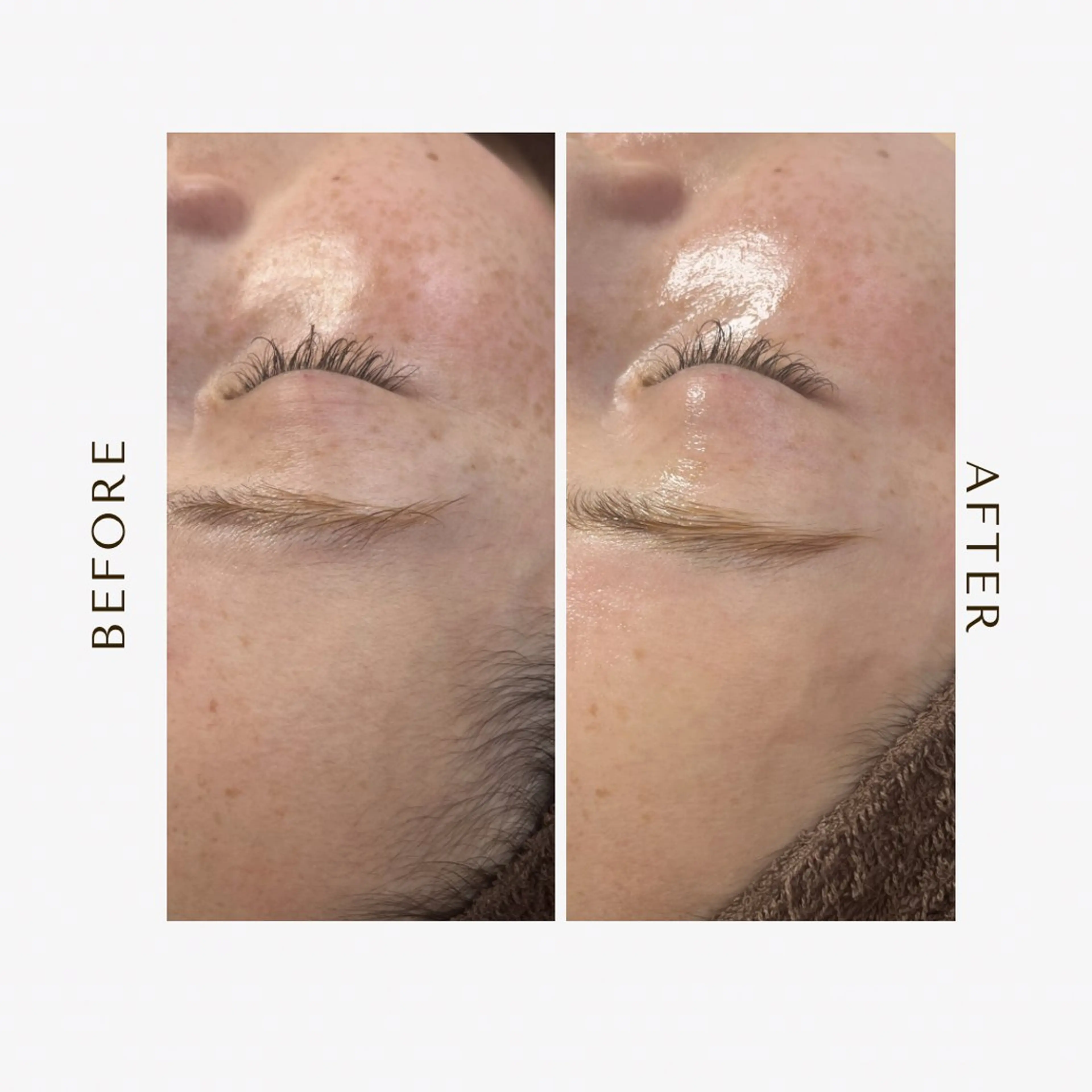 脱毛 1st｜フェイシャル エステ専門店のエステ・リラクイメージ