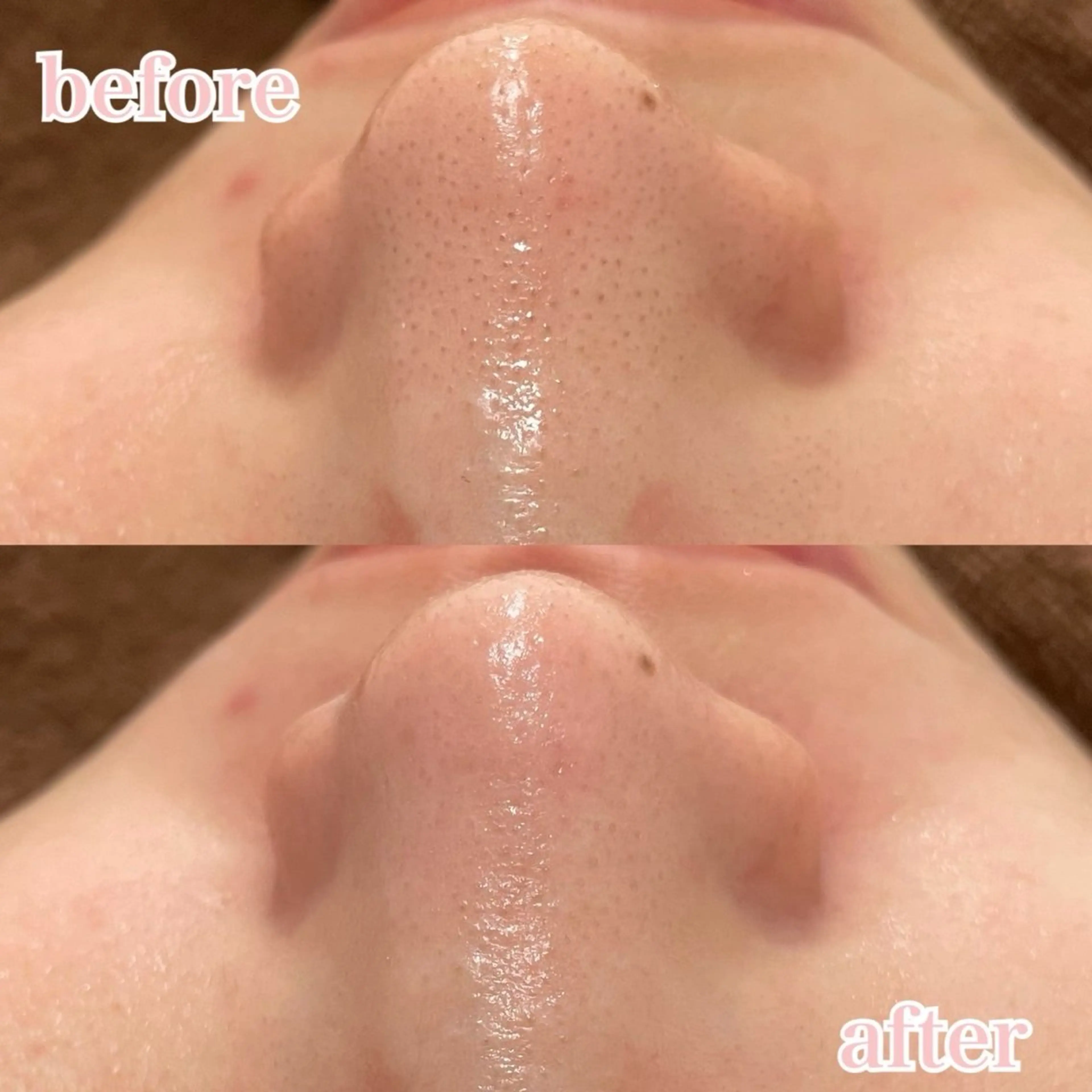 肌管理専門店Whitelabo堺東店所属・おだ あみのエステ・リラクイメージ