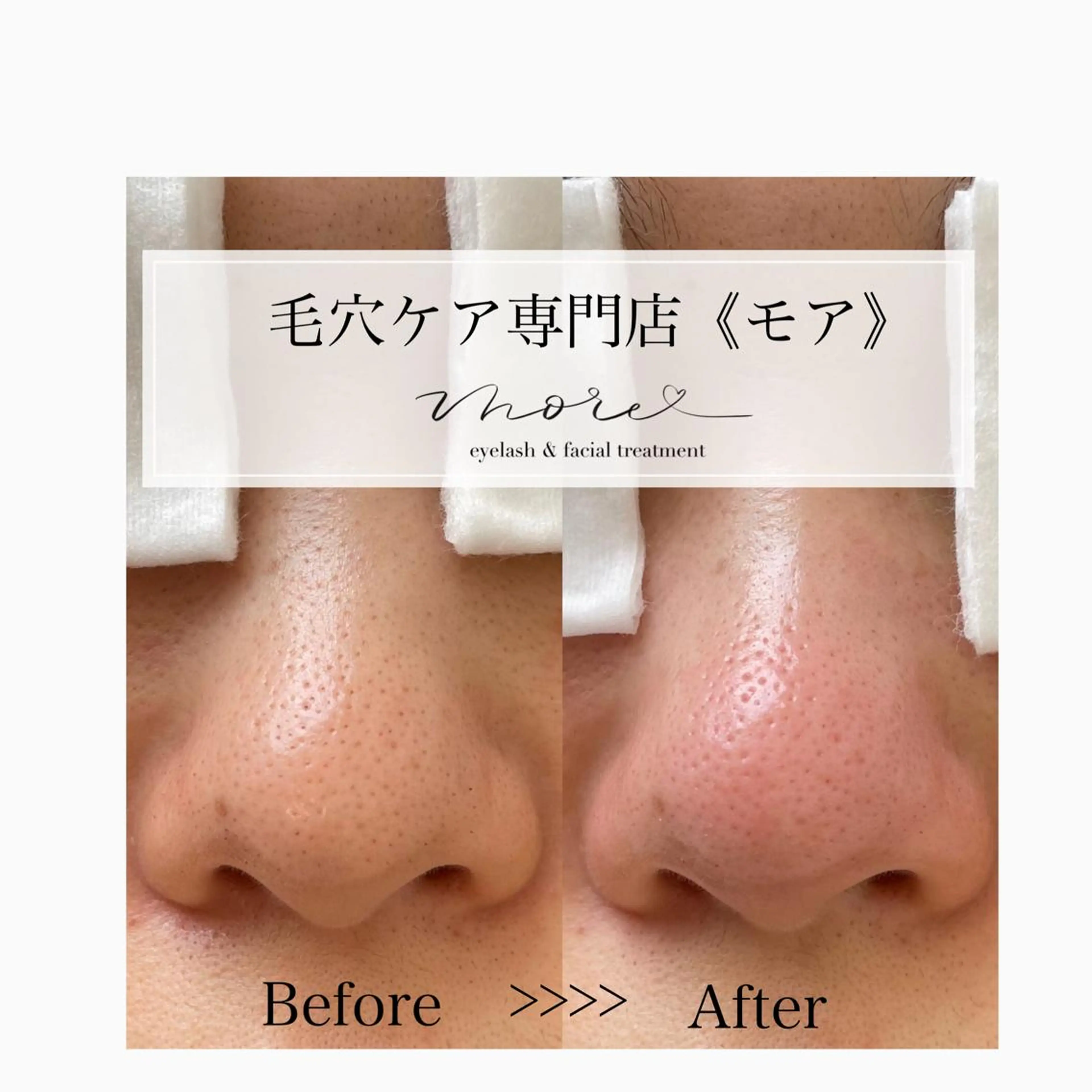 Eyelash salon MORE(モア)所属・安納 麻穂のエステ・リラクイメージ